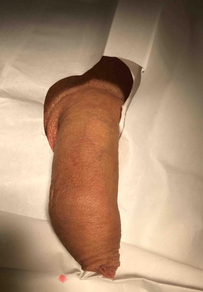 Patient A — clinical photograph 4 of 5