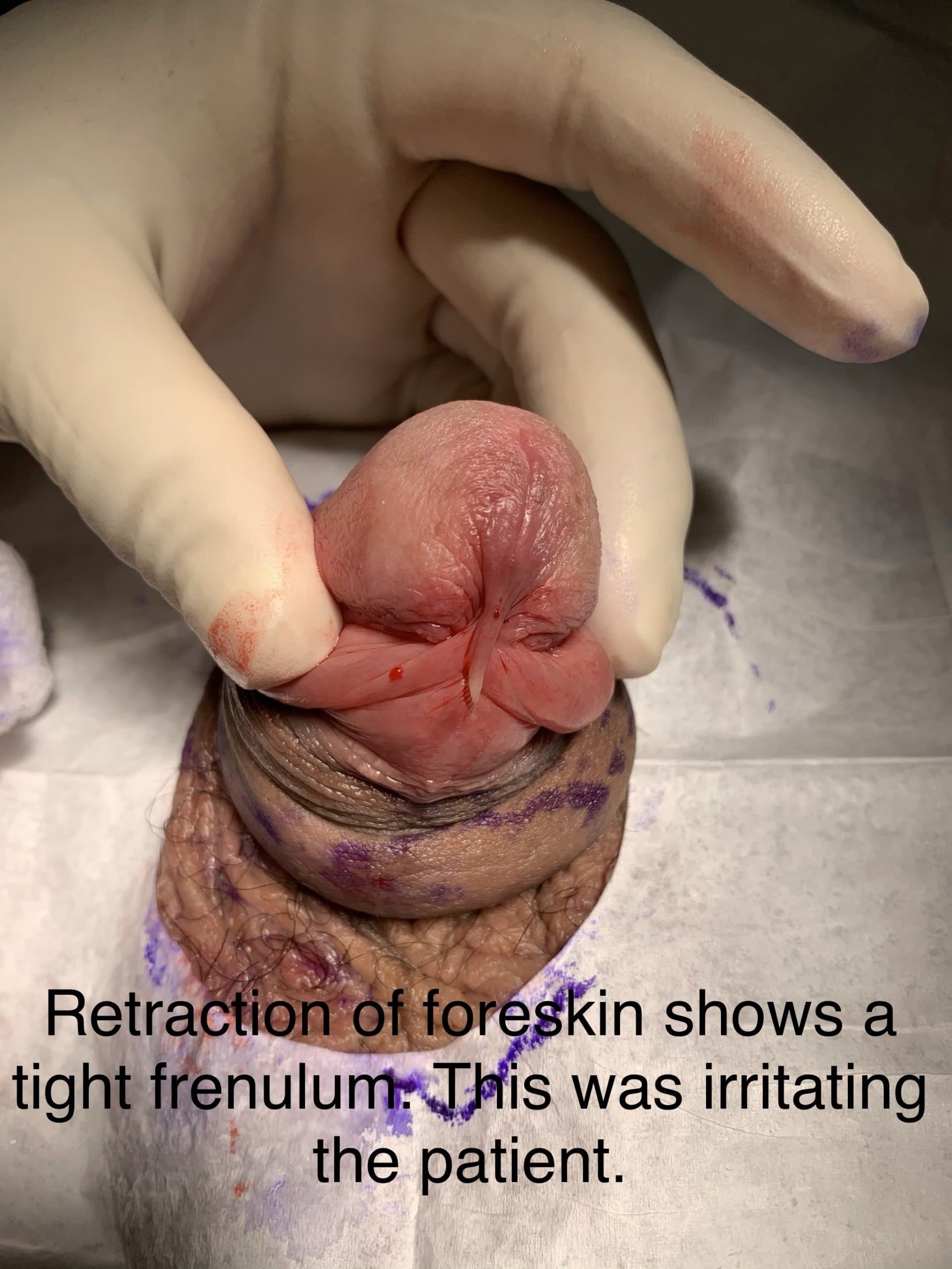 Patient B — clinical photograph 3 of 6