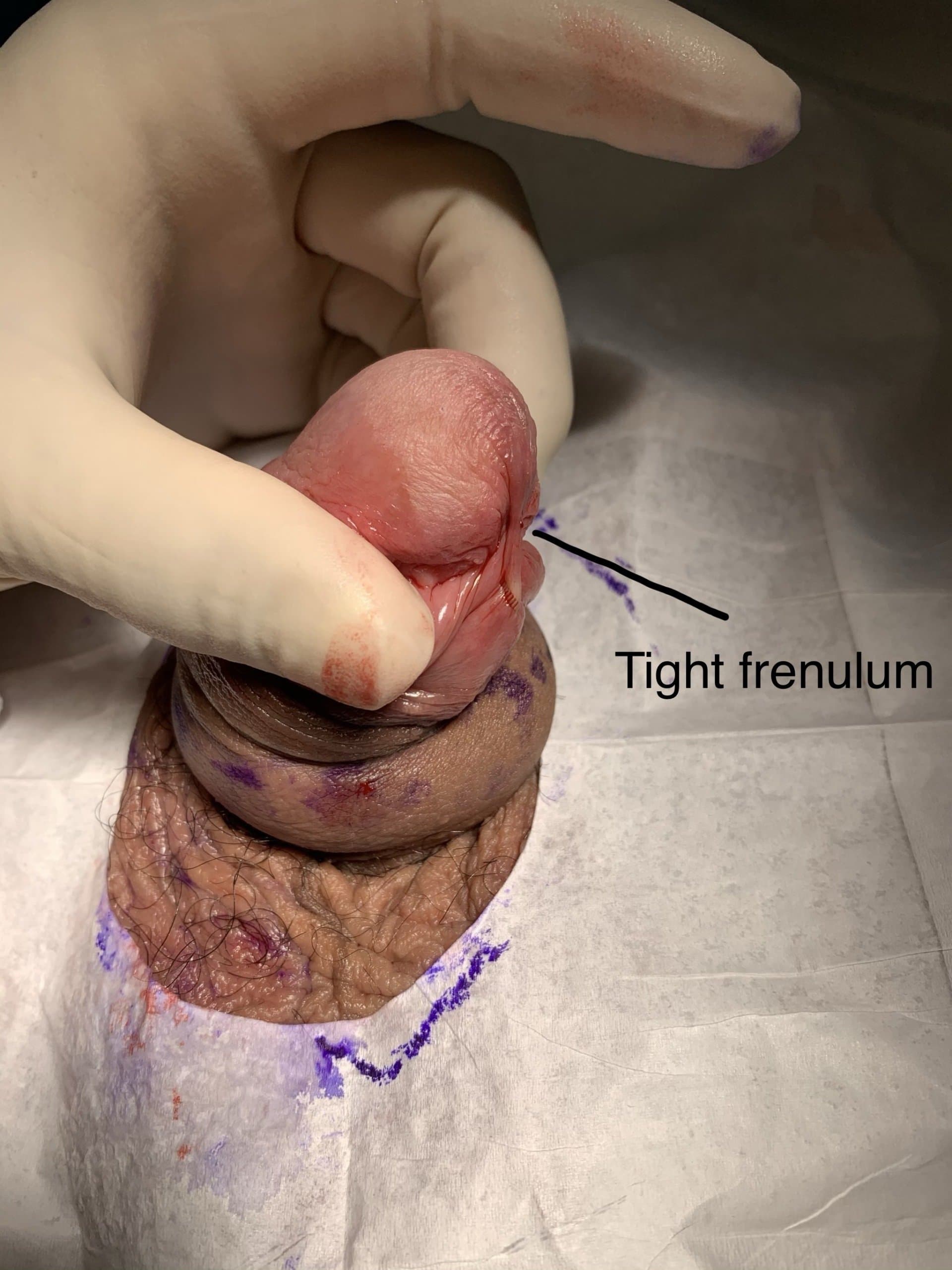 Patient B — clinical photograph 4 of 6