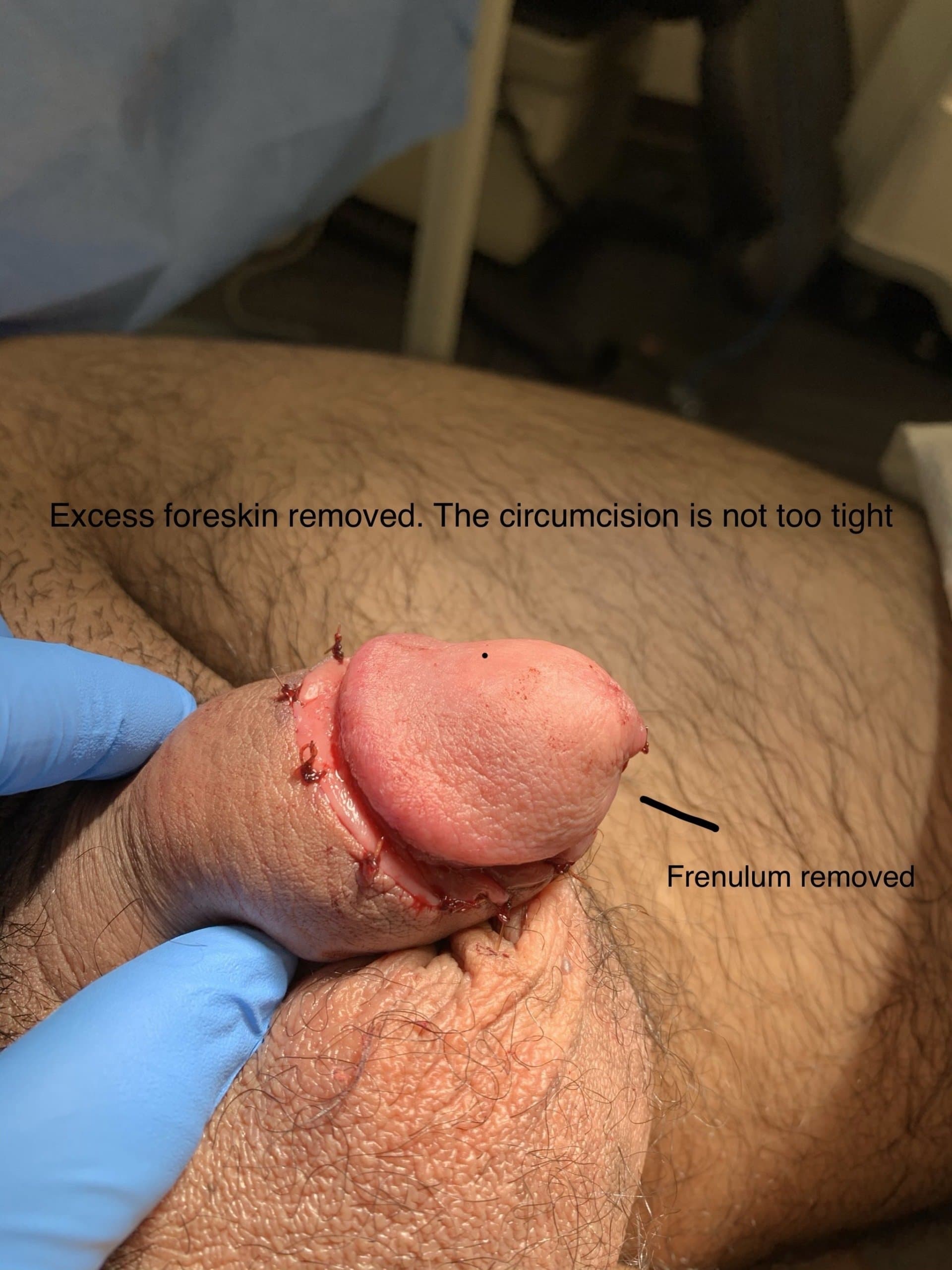 Patient B — clinical photograph 5 of 6