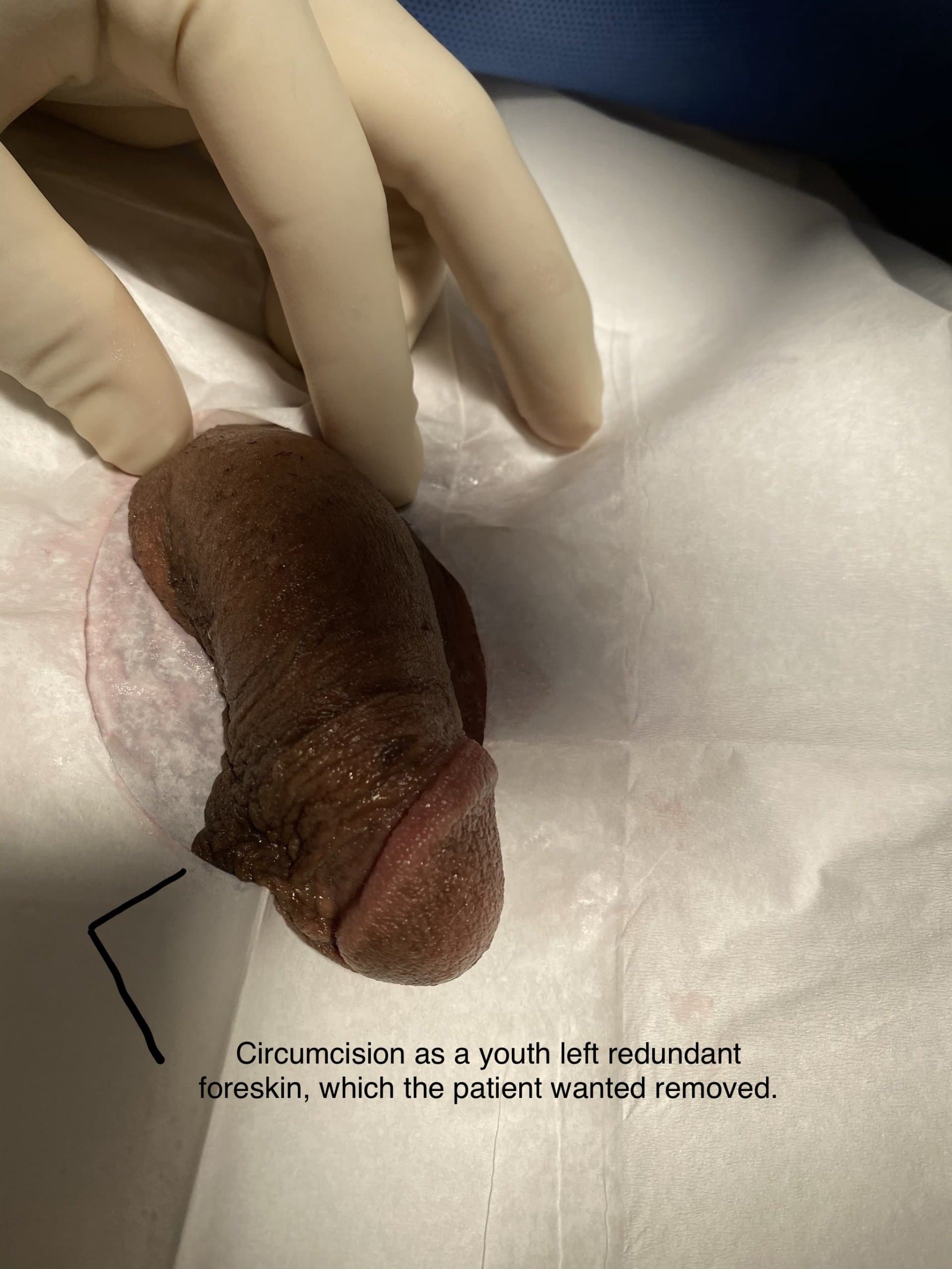 Patient C — clinical photograph 1 of 5