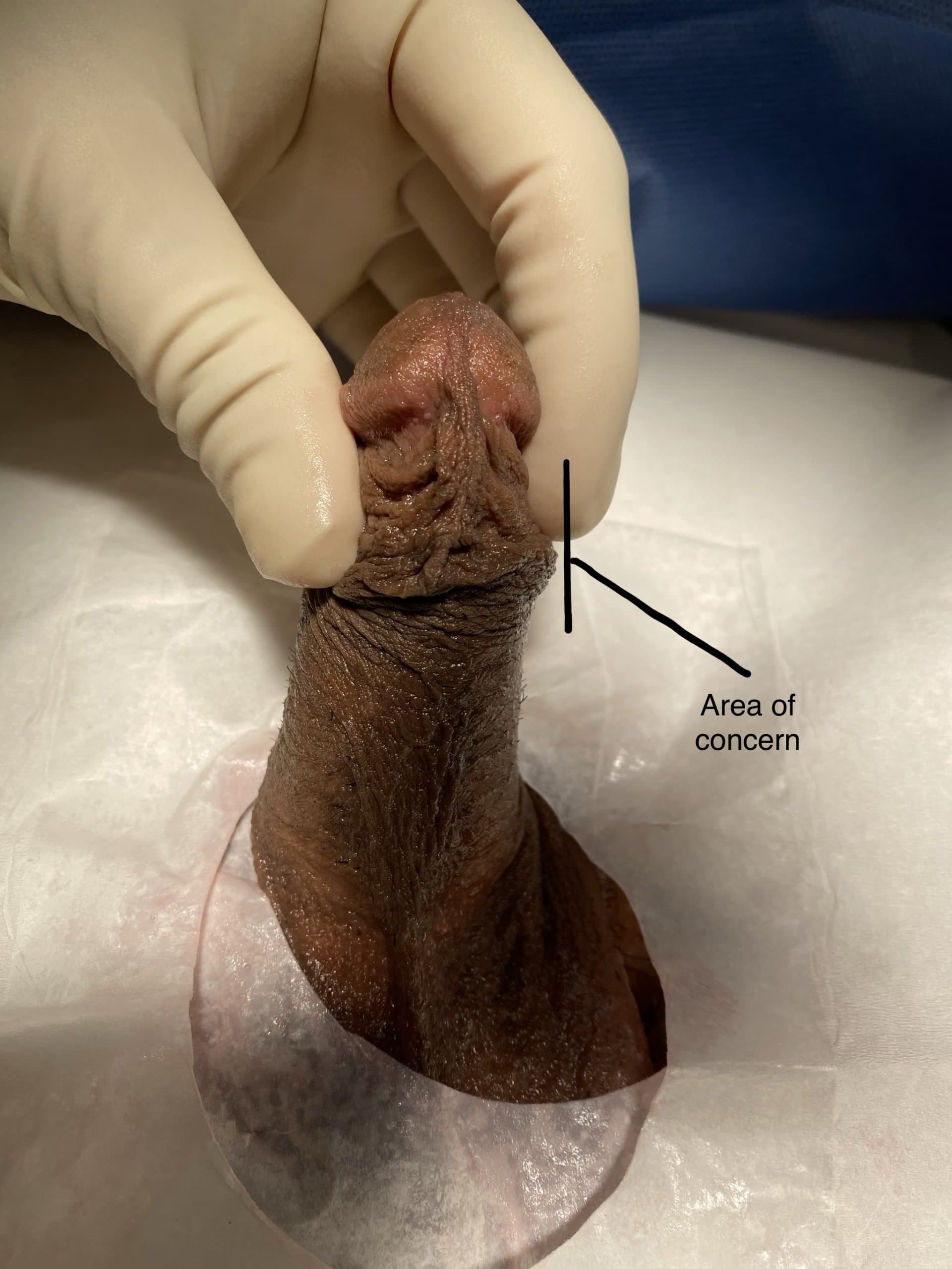 Patient C — clinical photograph 2 of 5