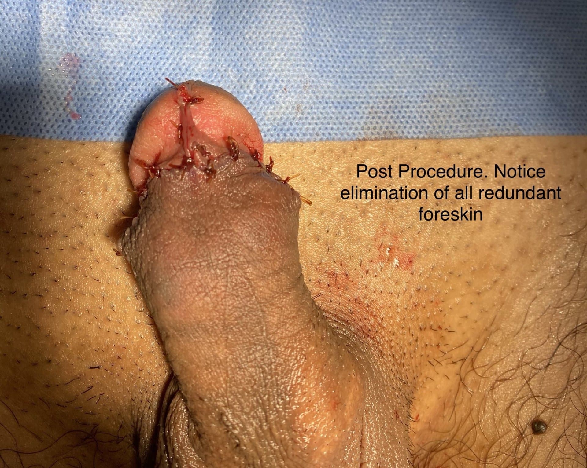 Patient C — clinical photograph 4 of 5