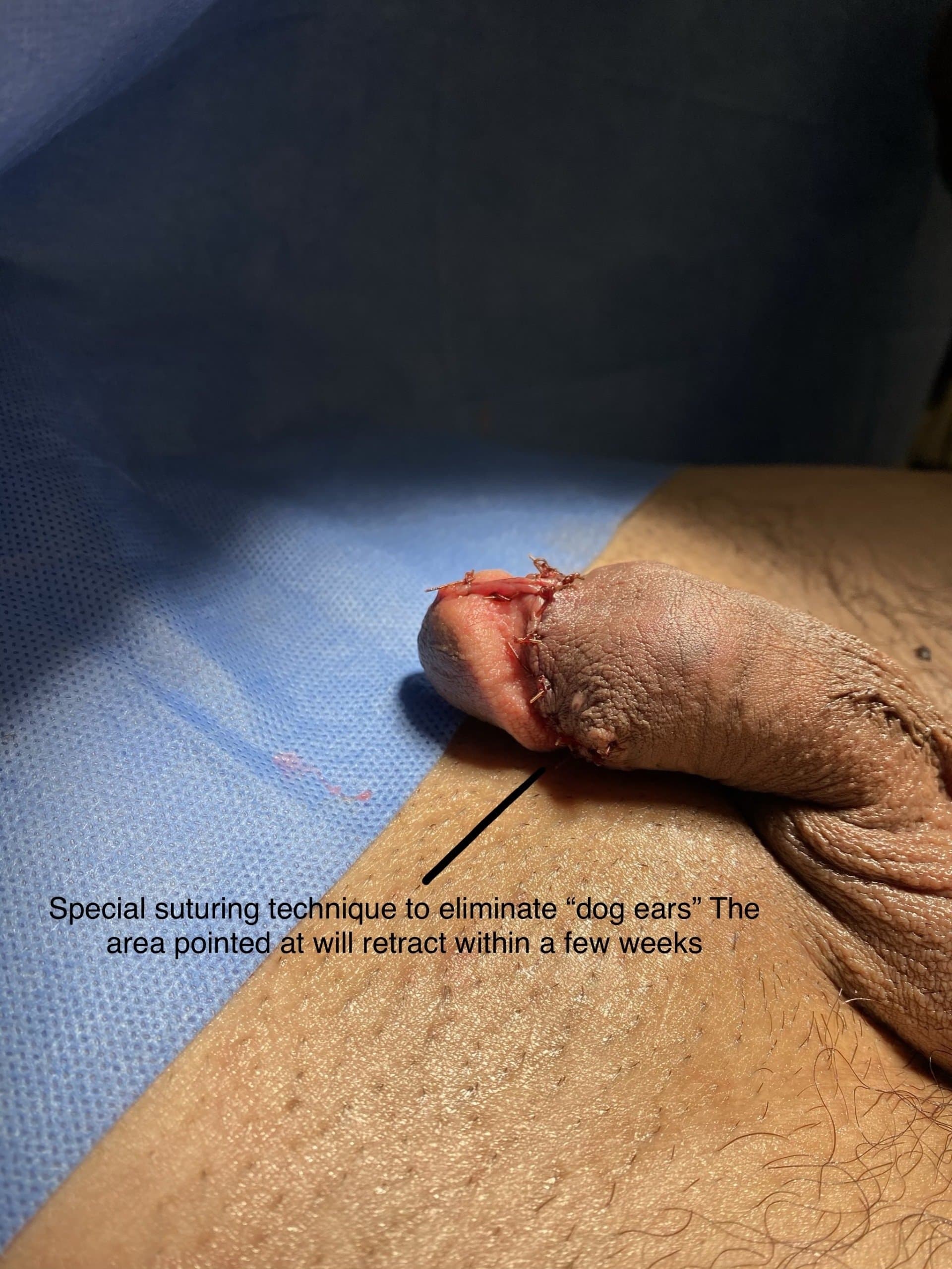 Patient C — clinical photograph 5 of 5