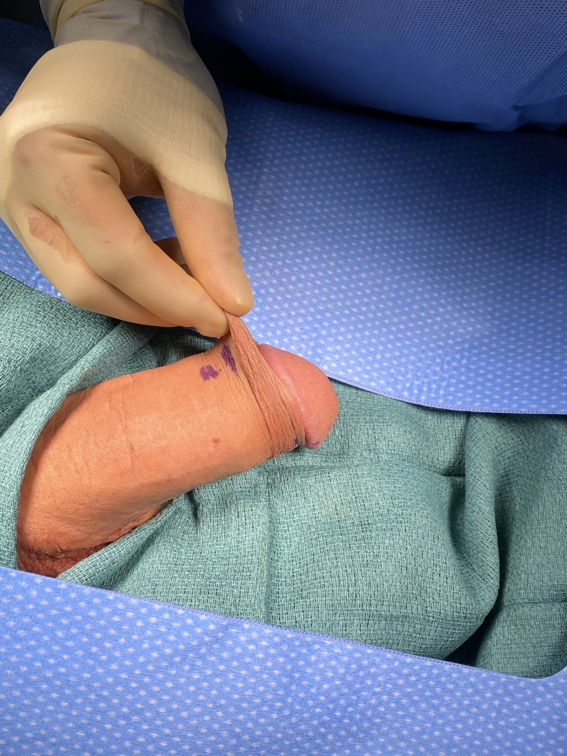 Patient D — clinical photograph 4 of 8