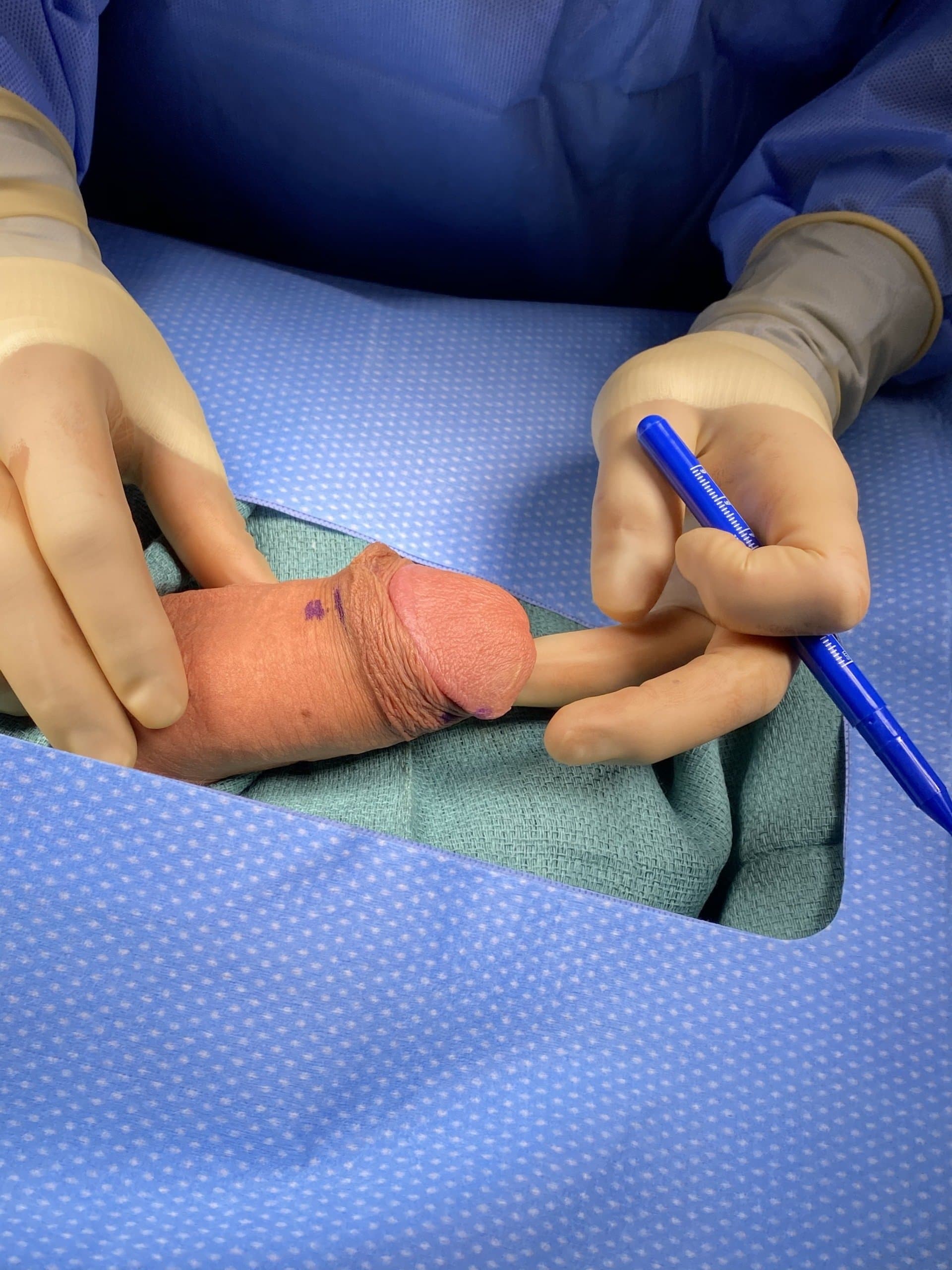 Patient D — clinical photograph 5 of 8