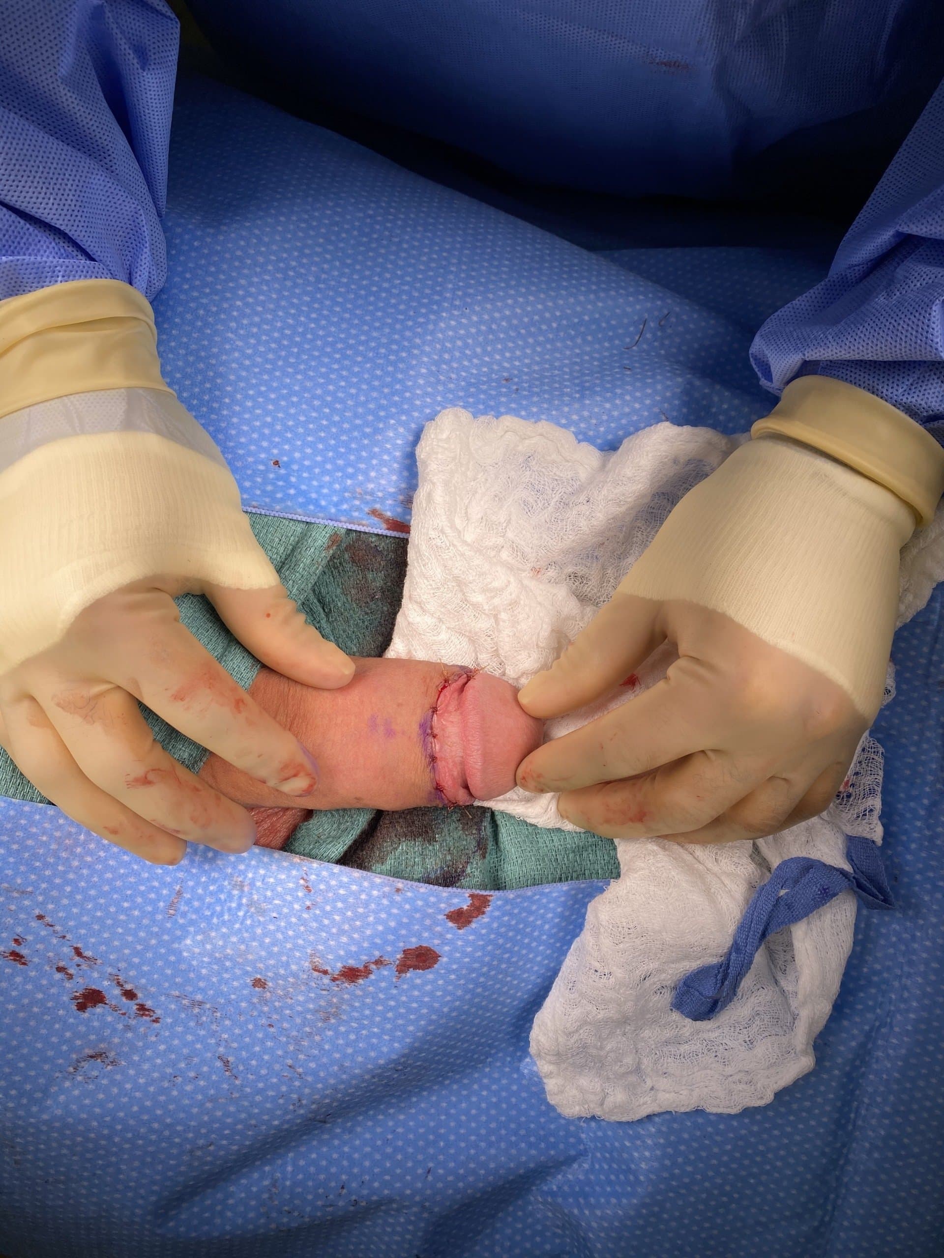 Patient D — clinical photograph 6 of 8