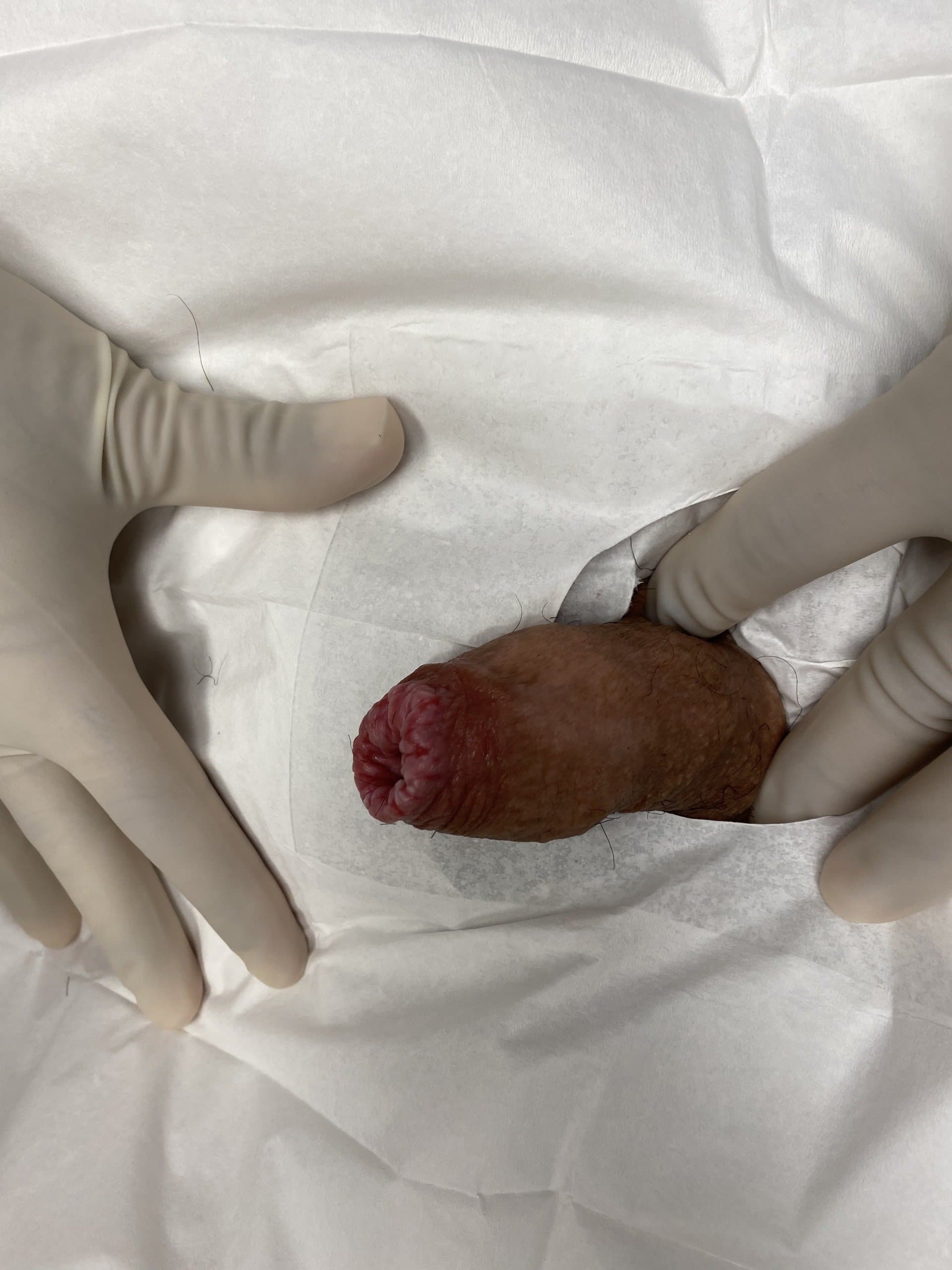 Patient F — clinical photograph 1 of 4