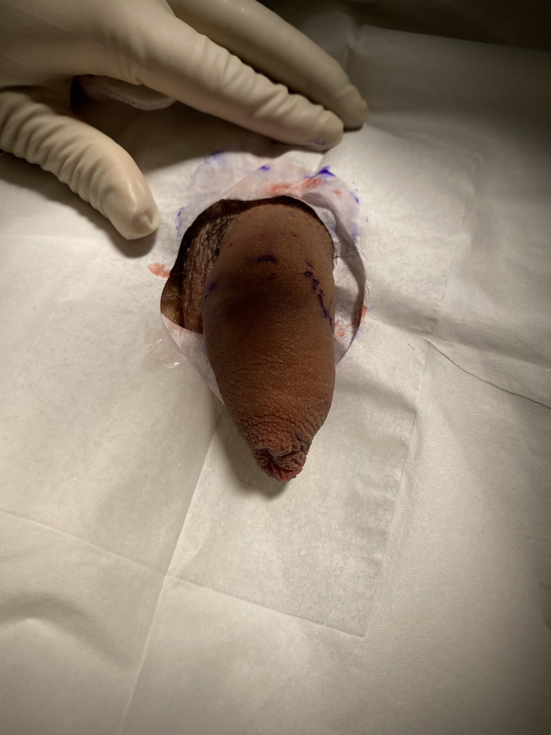 Patient G — clinical photograph 1 of 4