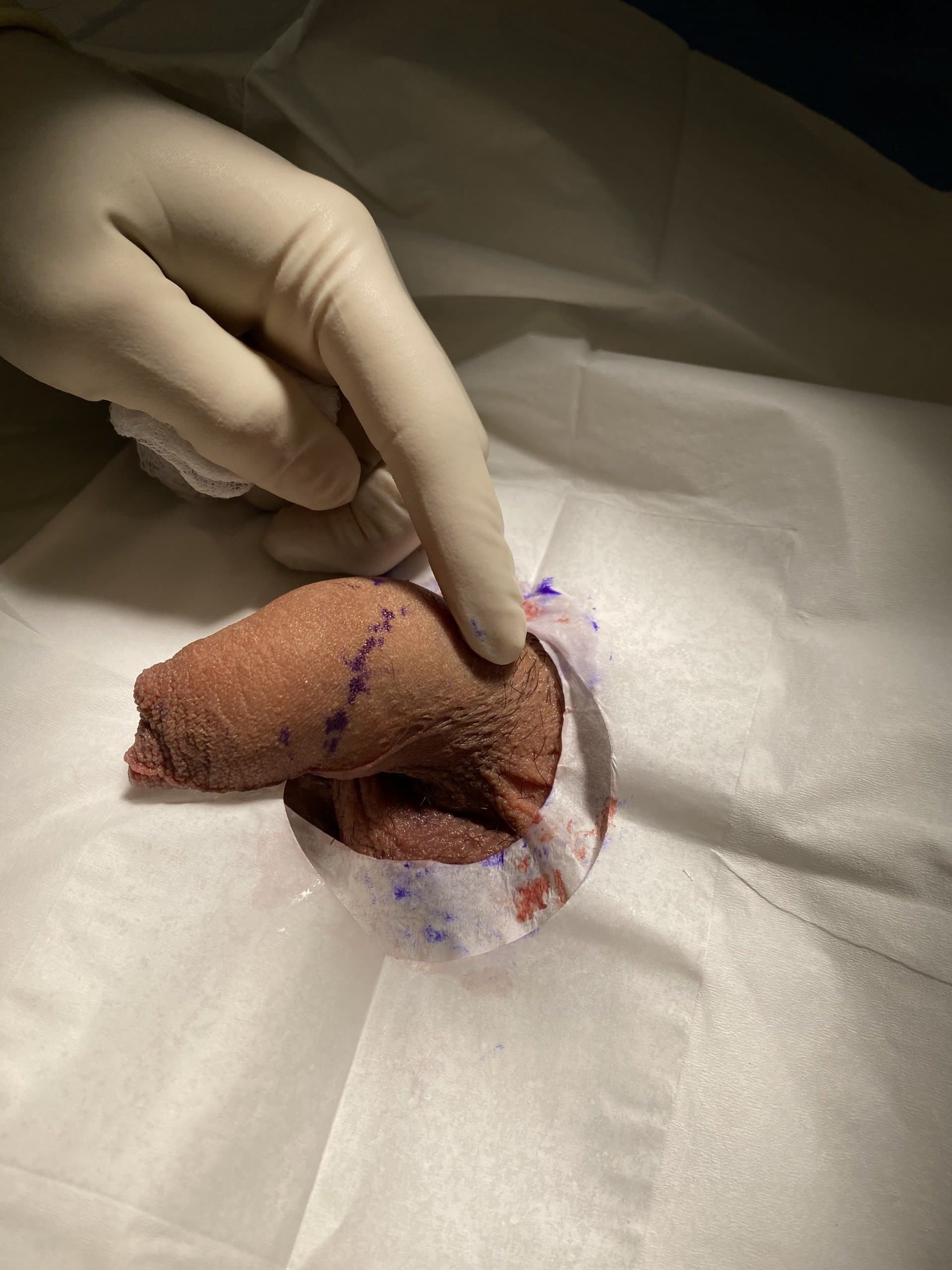 Patient G — clinical photograph 2 of 4