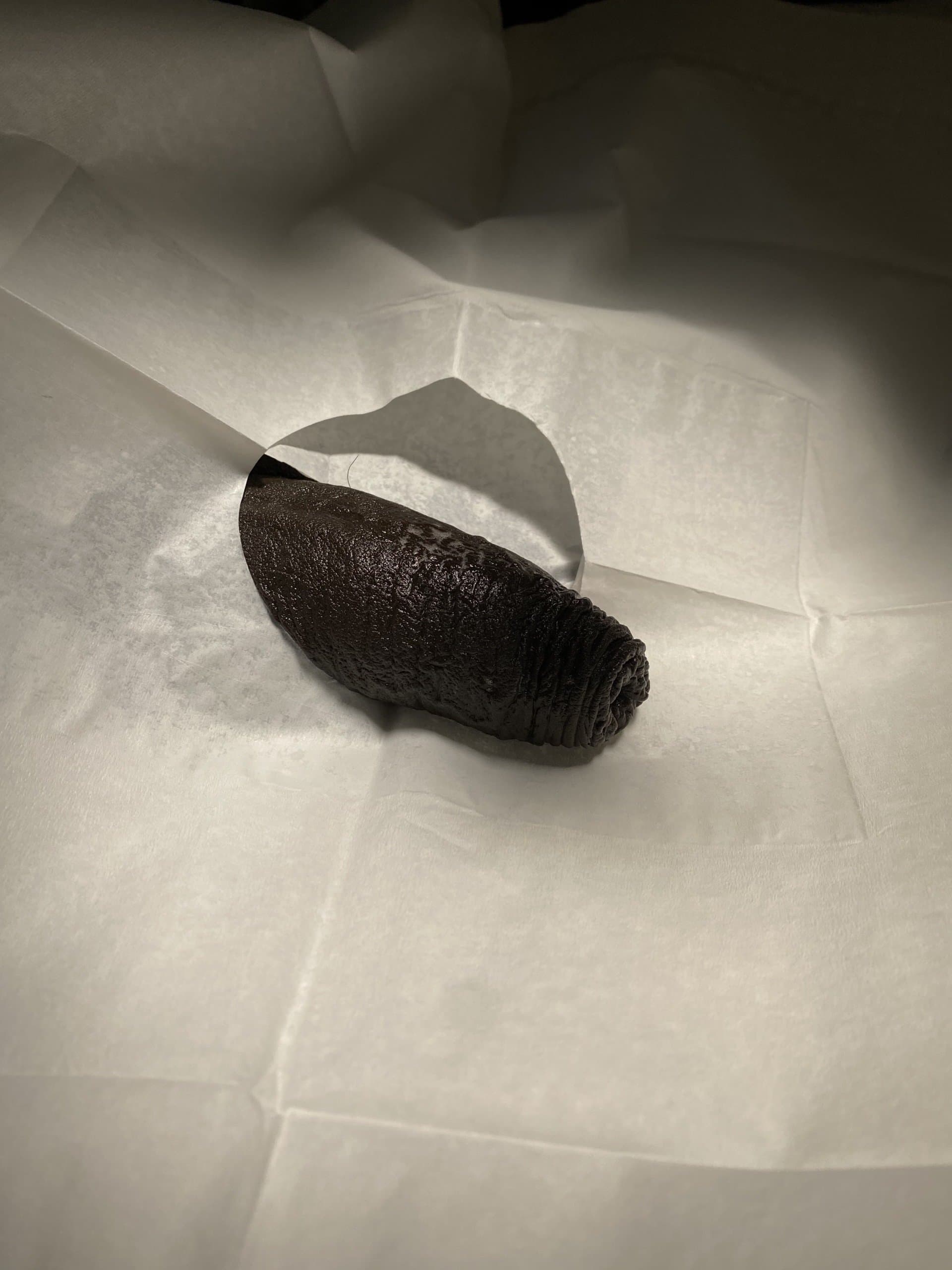 Patient H — clinical photograph 2 of 6