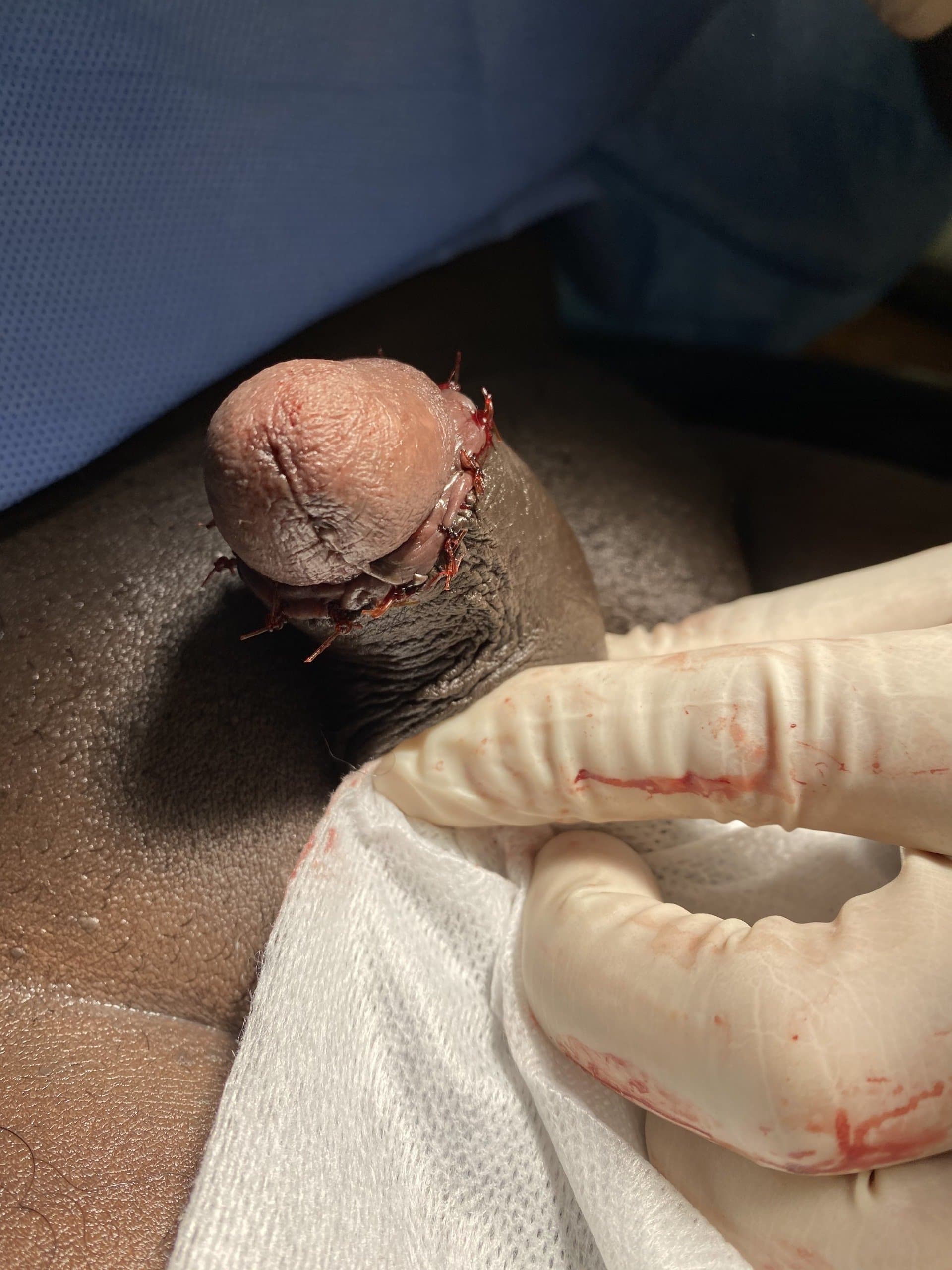 Patient H — clinical photograph 3 of 6