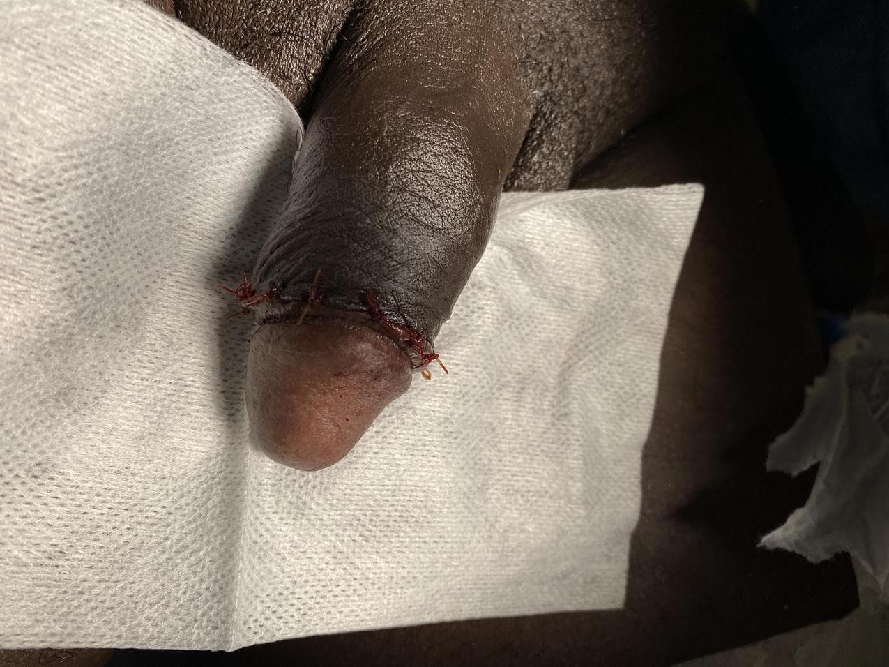 Patient H — clinical photograph 5 of 6