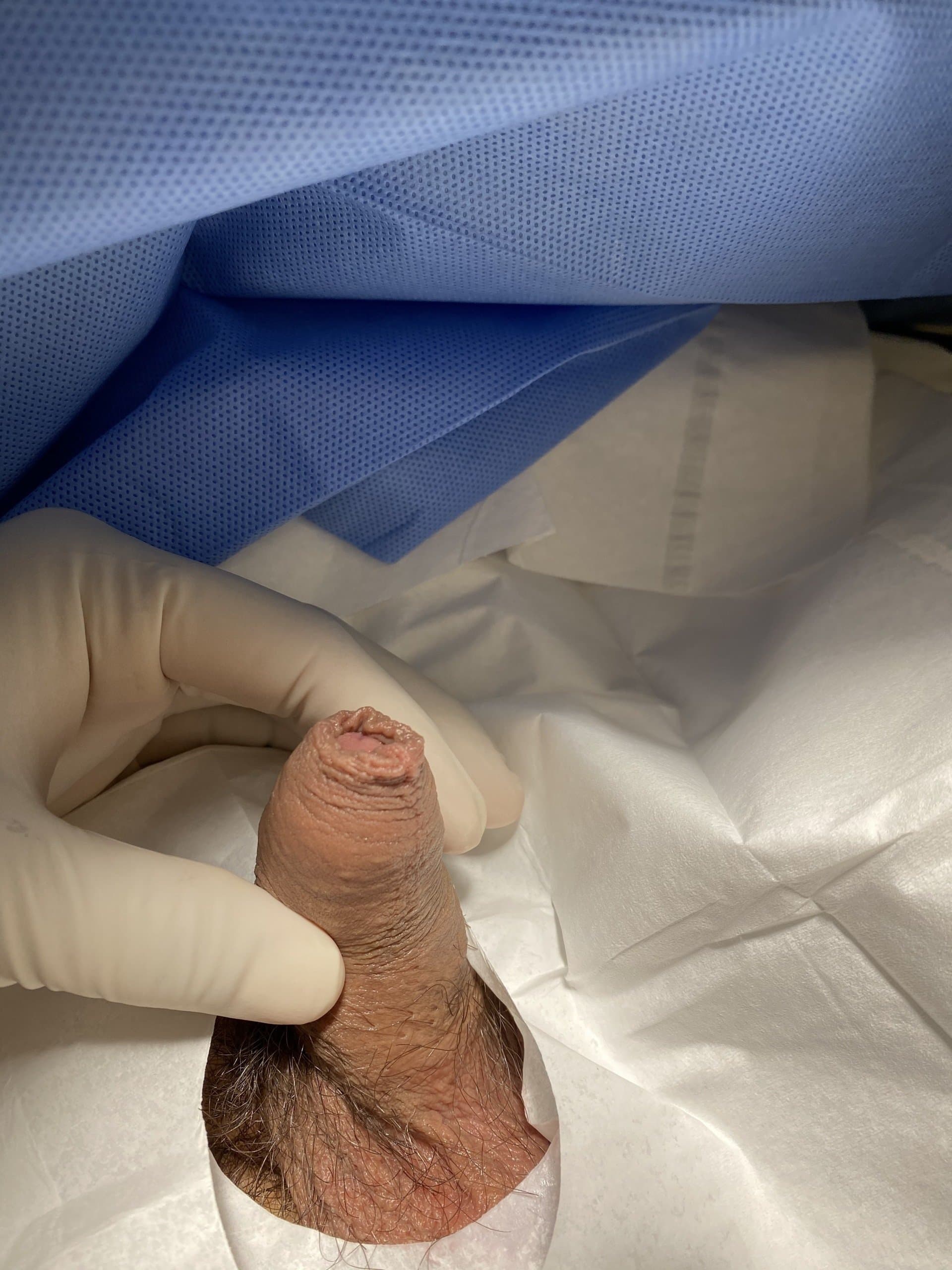 Patient I — clinical photograph 2 of 4