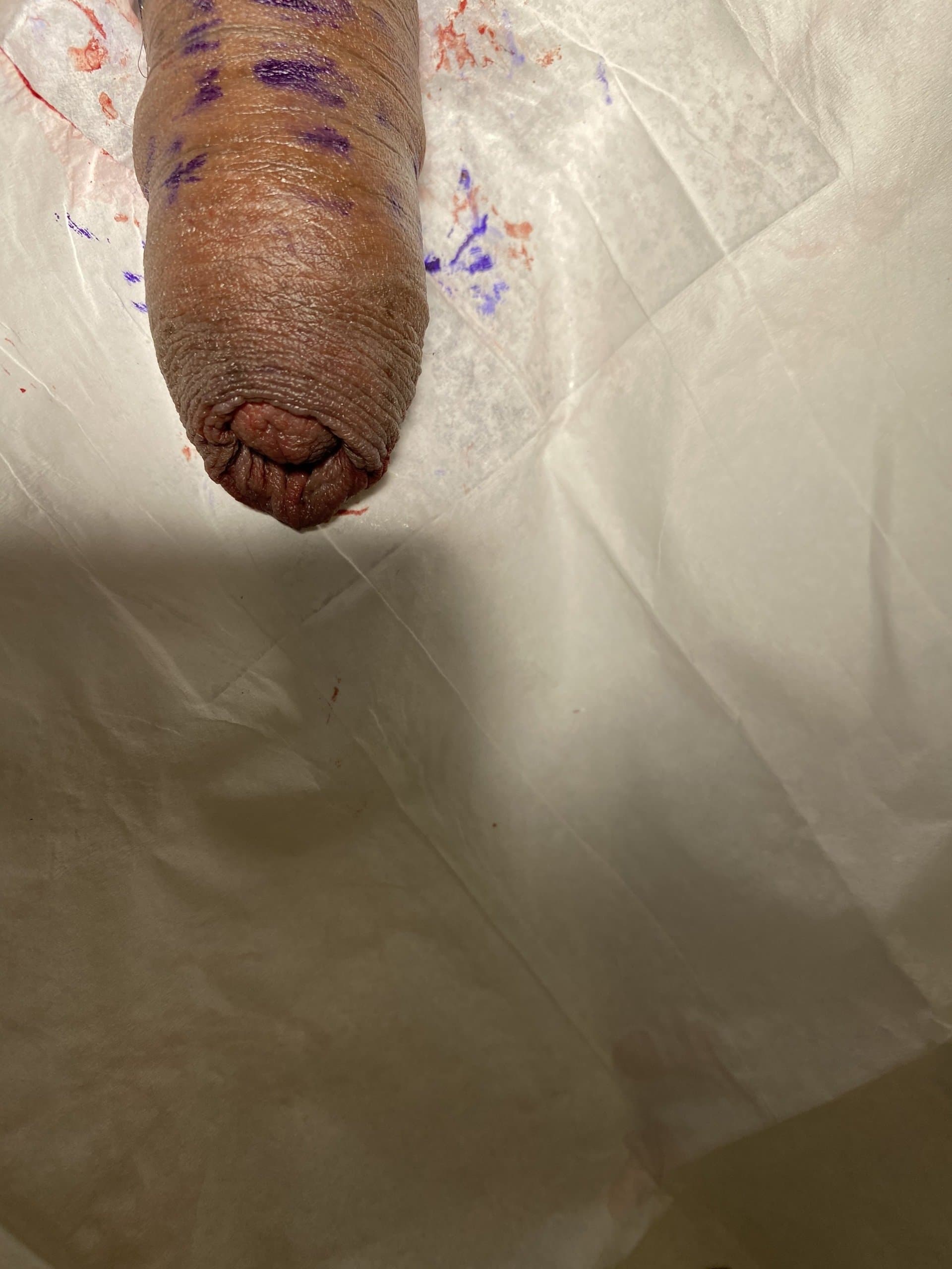 Patient J — clinical photograph 2 of 6