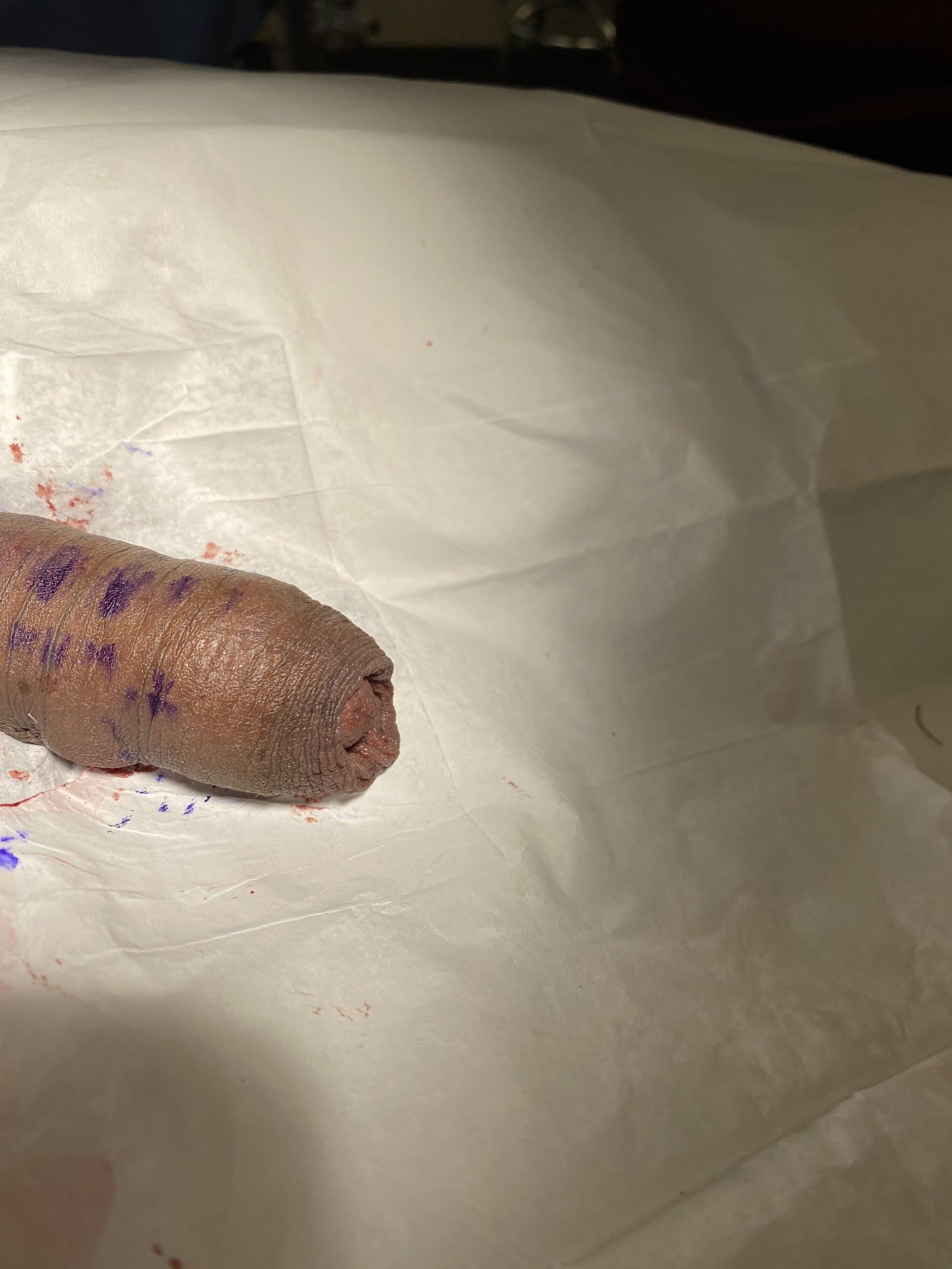 Patient J — clinical photograph 4 of 6