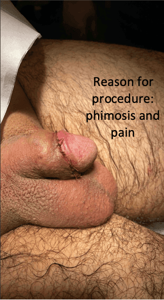 Patient K — clinical photograph 1 of 3