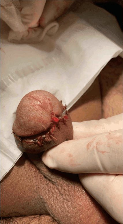 Patient K — clinical photograph 2 of 3