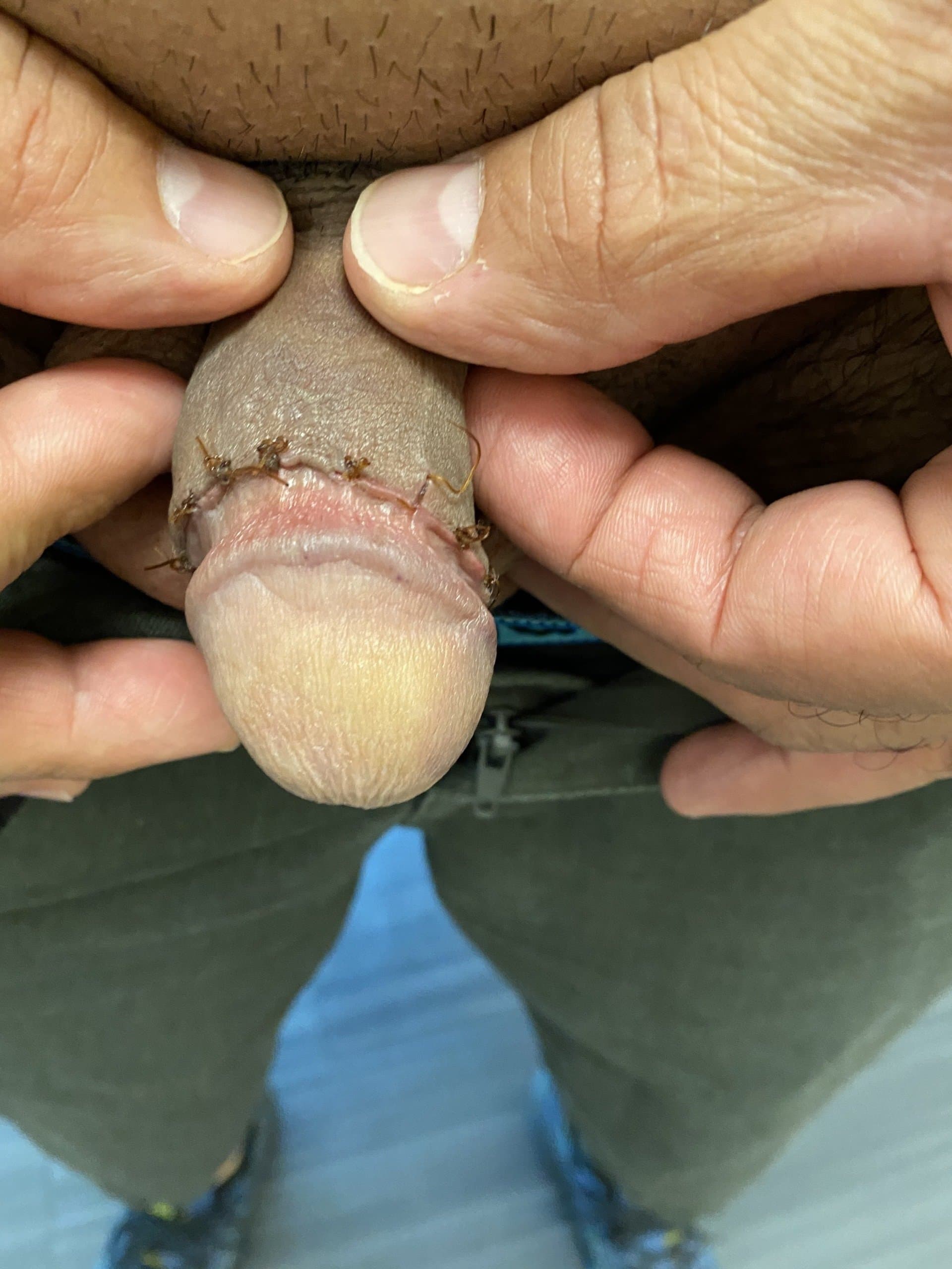 Patient K — clinical photograph 3 of 3