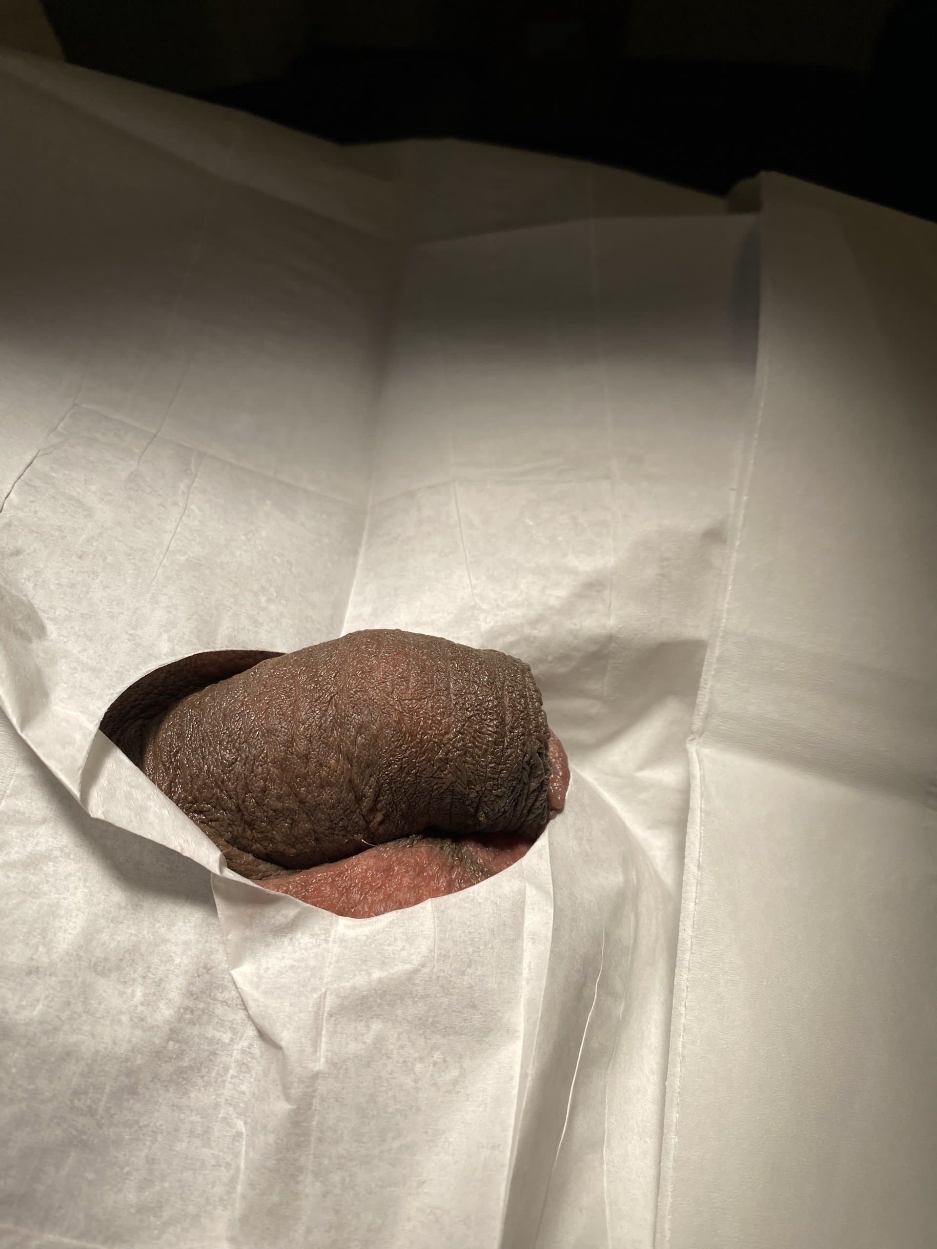 Patient L — clinical photograph 2 of 8