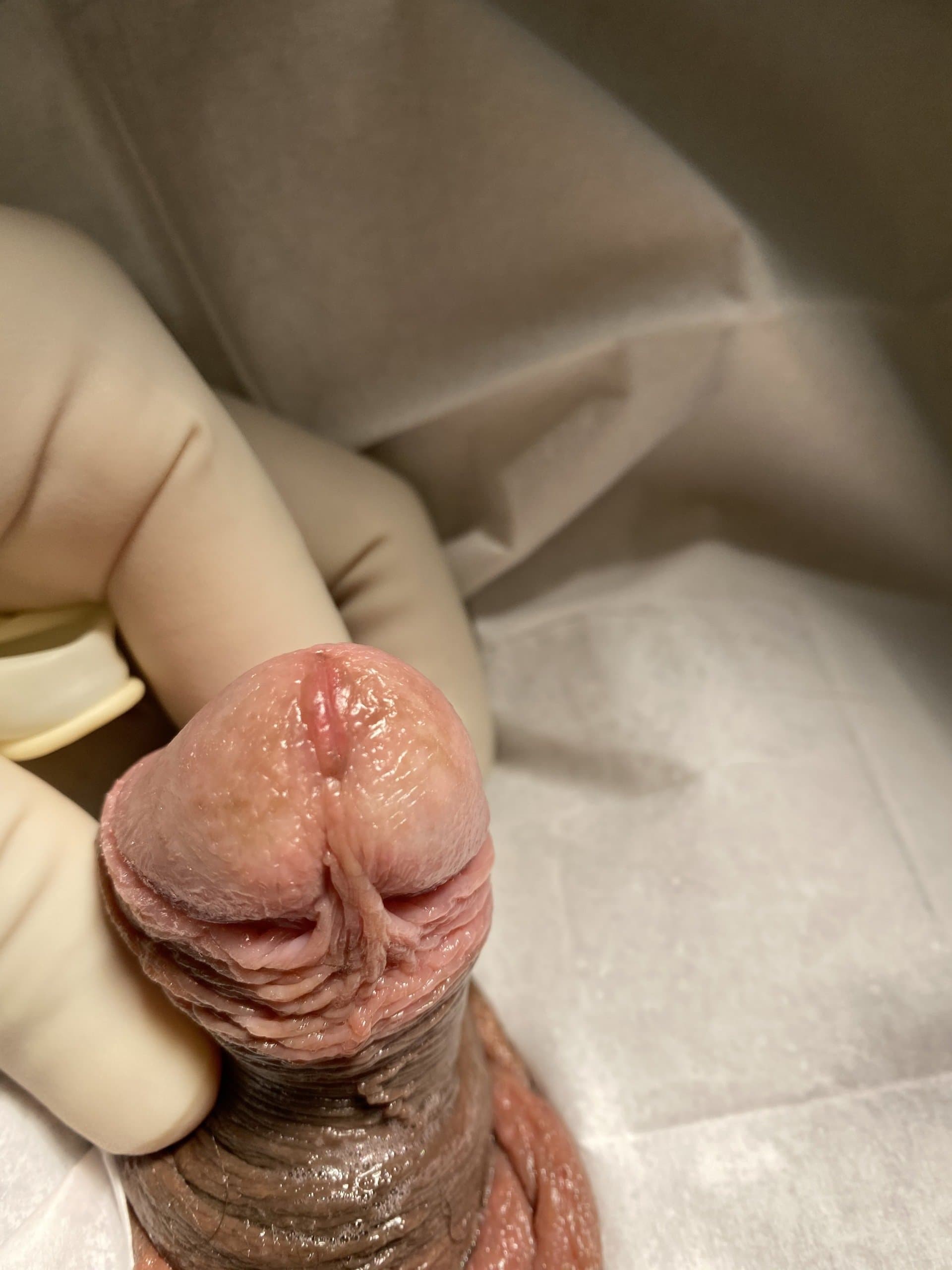 Patient L — clinical photograph 6 of 8