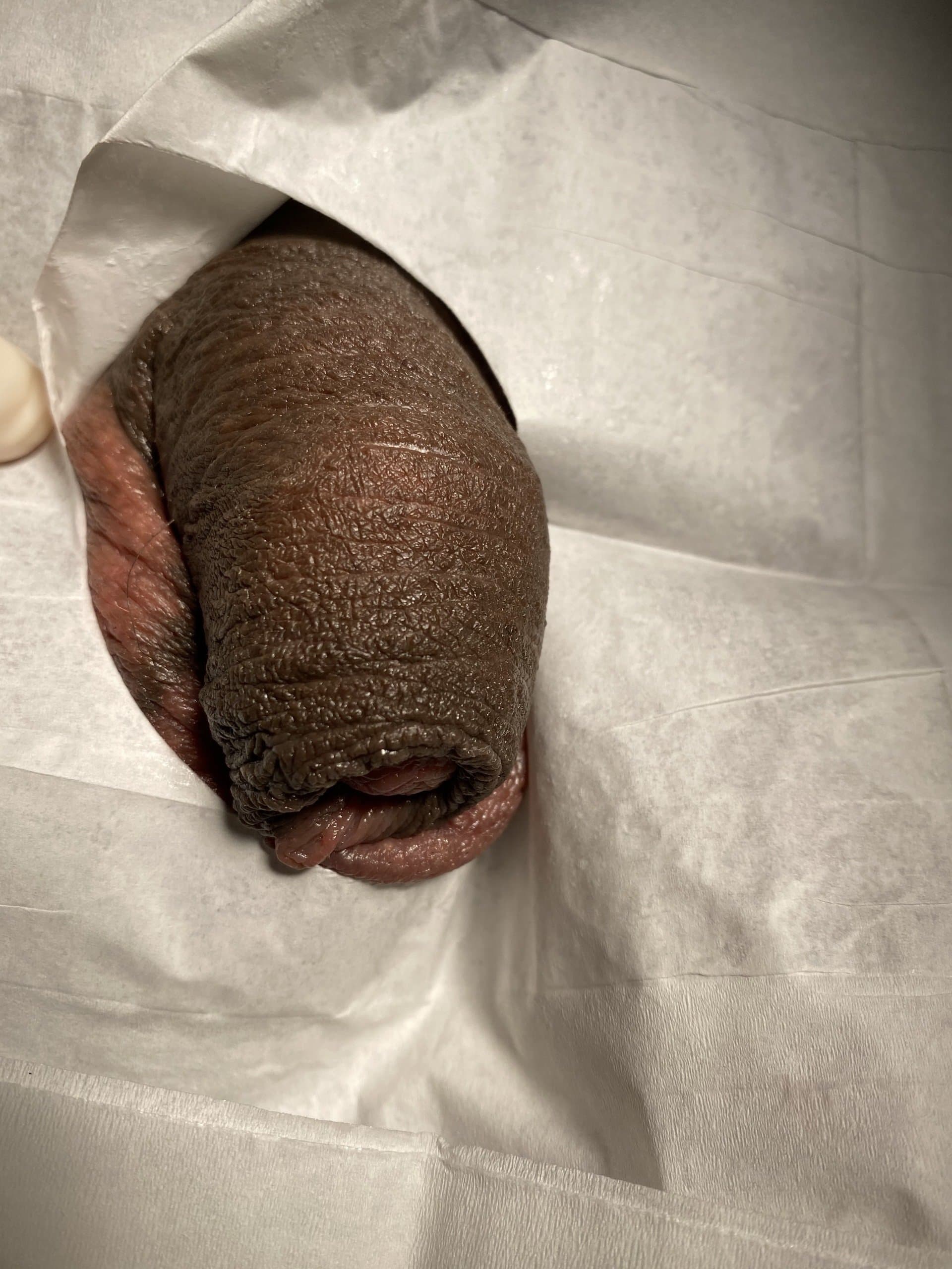 Patient M — clinical photograph 1 of 7