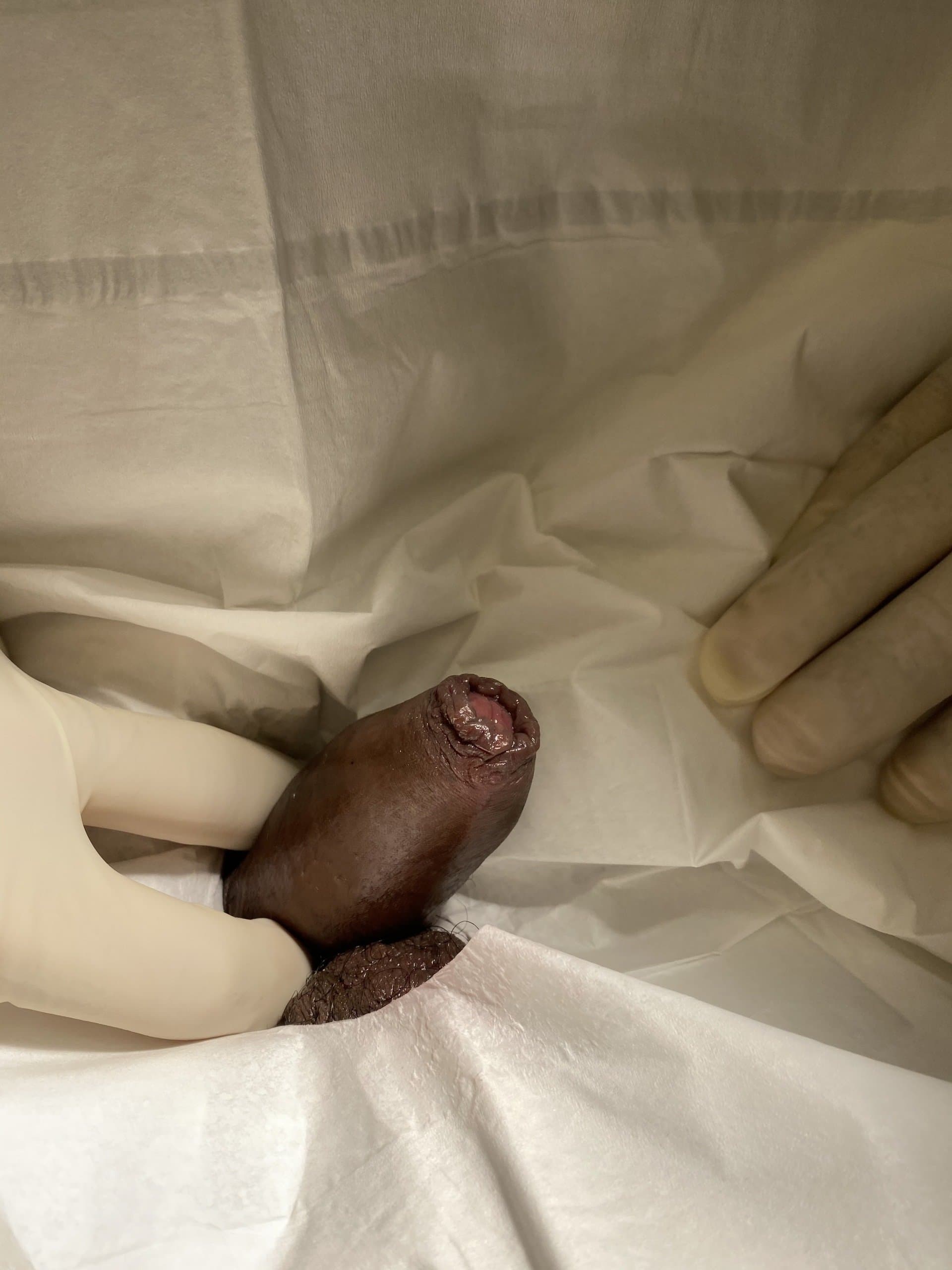 Patient M — clinical photograph 2 of 7