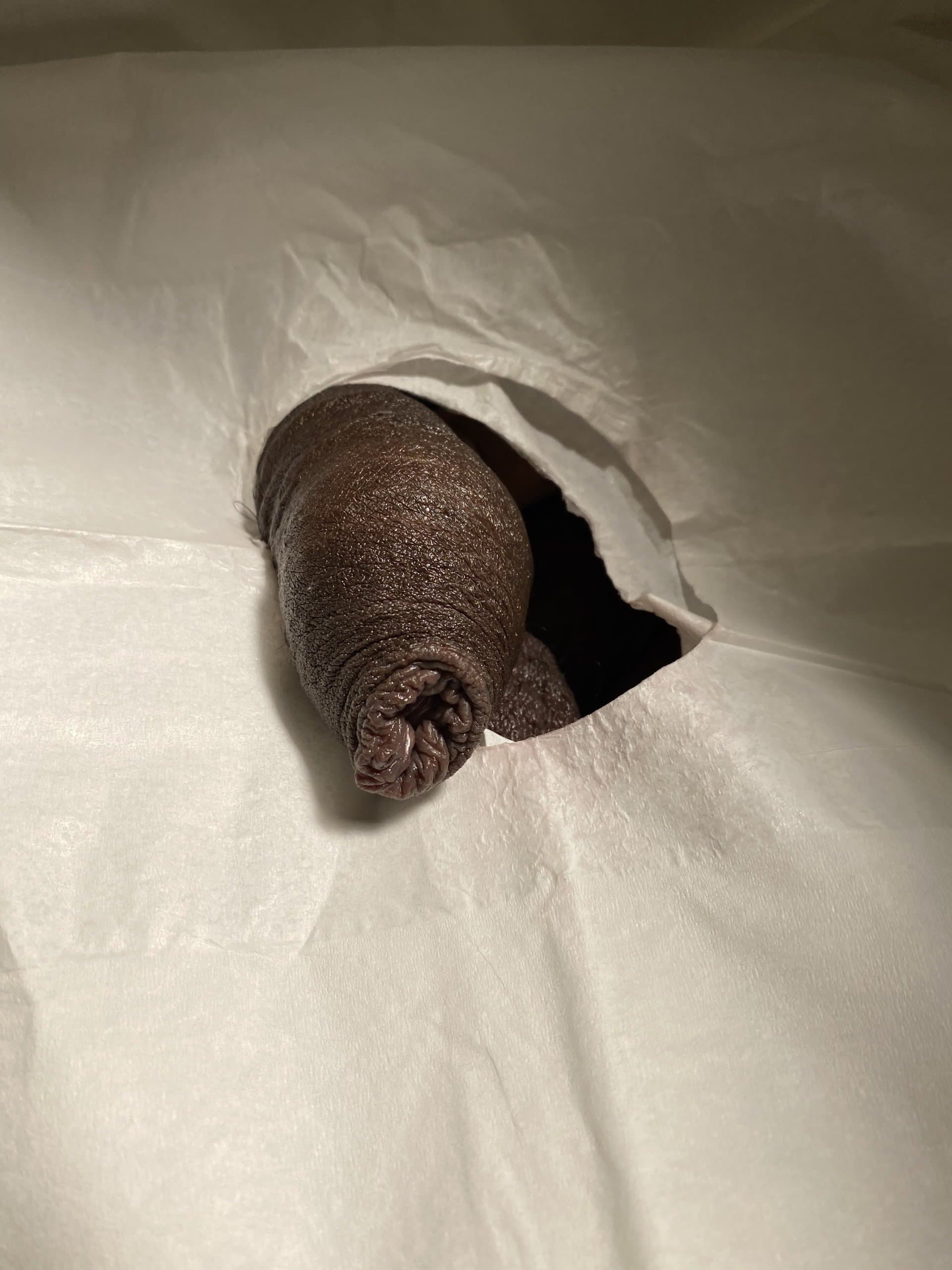 Patient M — clinical photograph 3 of 7