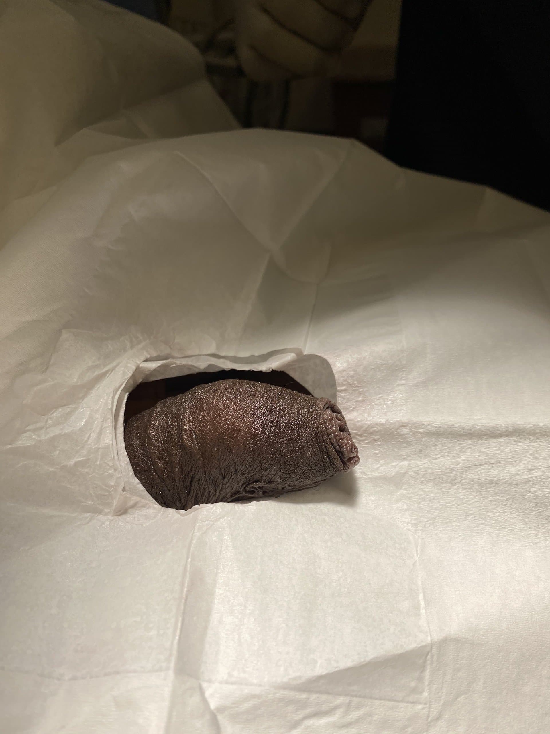 Patient M — clinical photograph 4 of 7