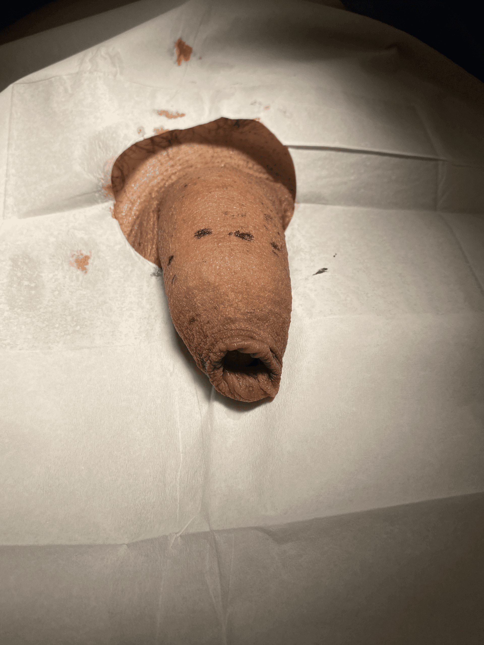 Patient N — clinical photograph 1 of 5