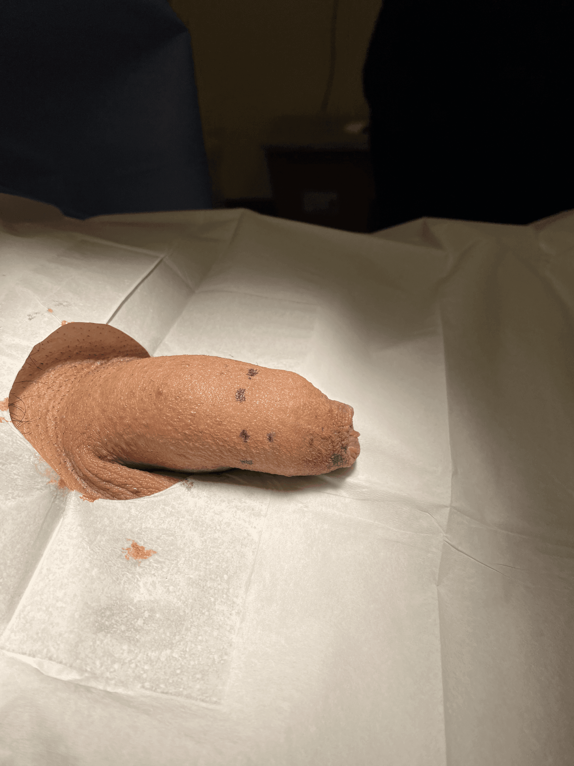 Patient N — clinical photograph 2 of 5