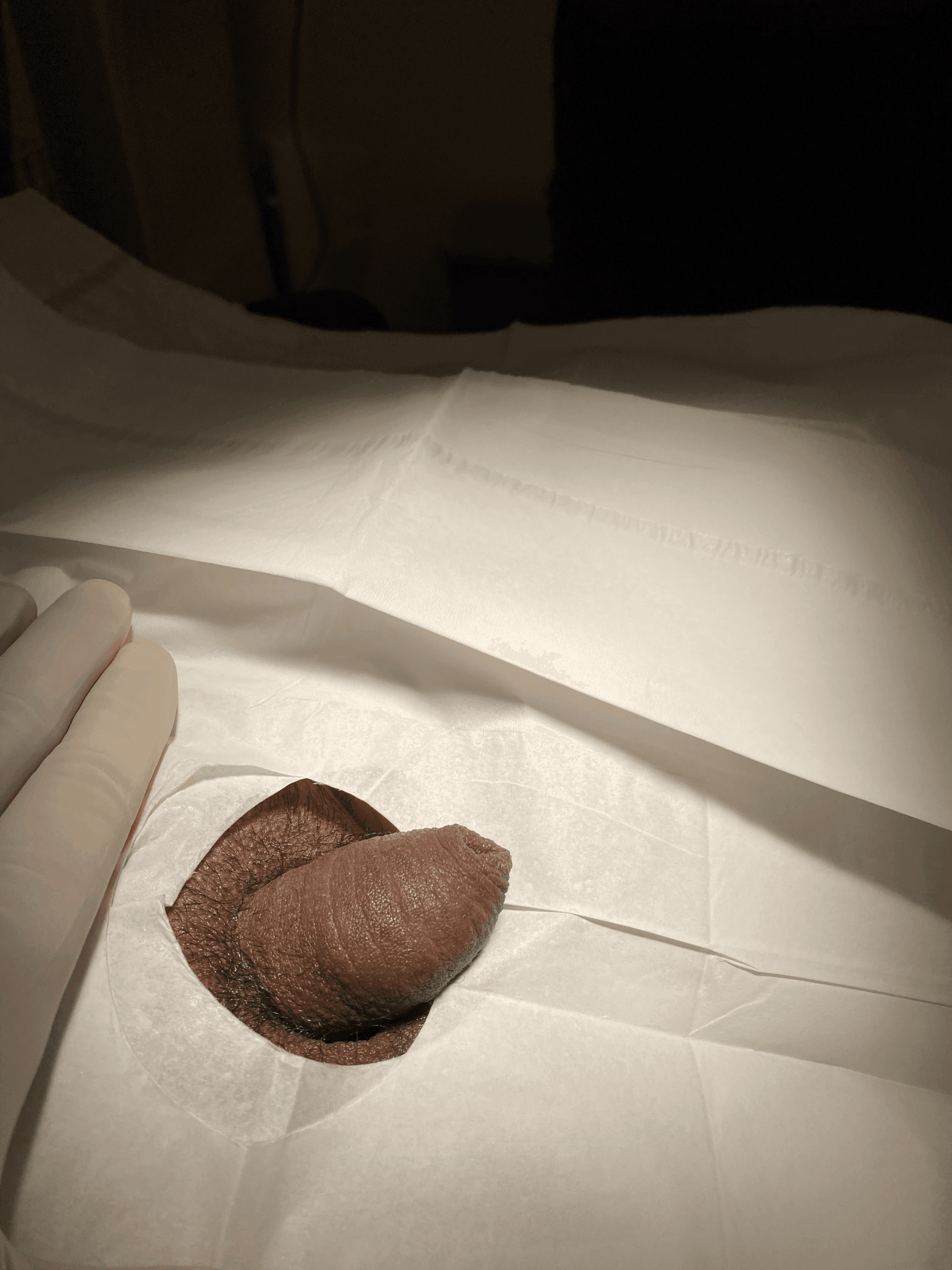 Patient N — clinical photograph 3 of 5