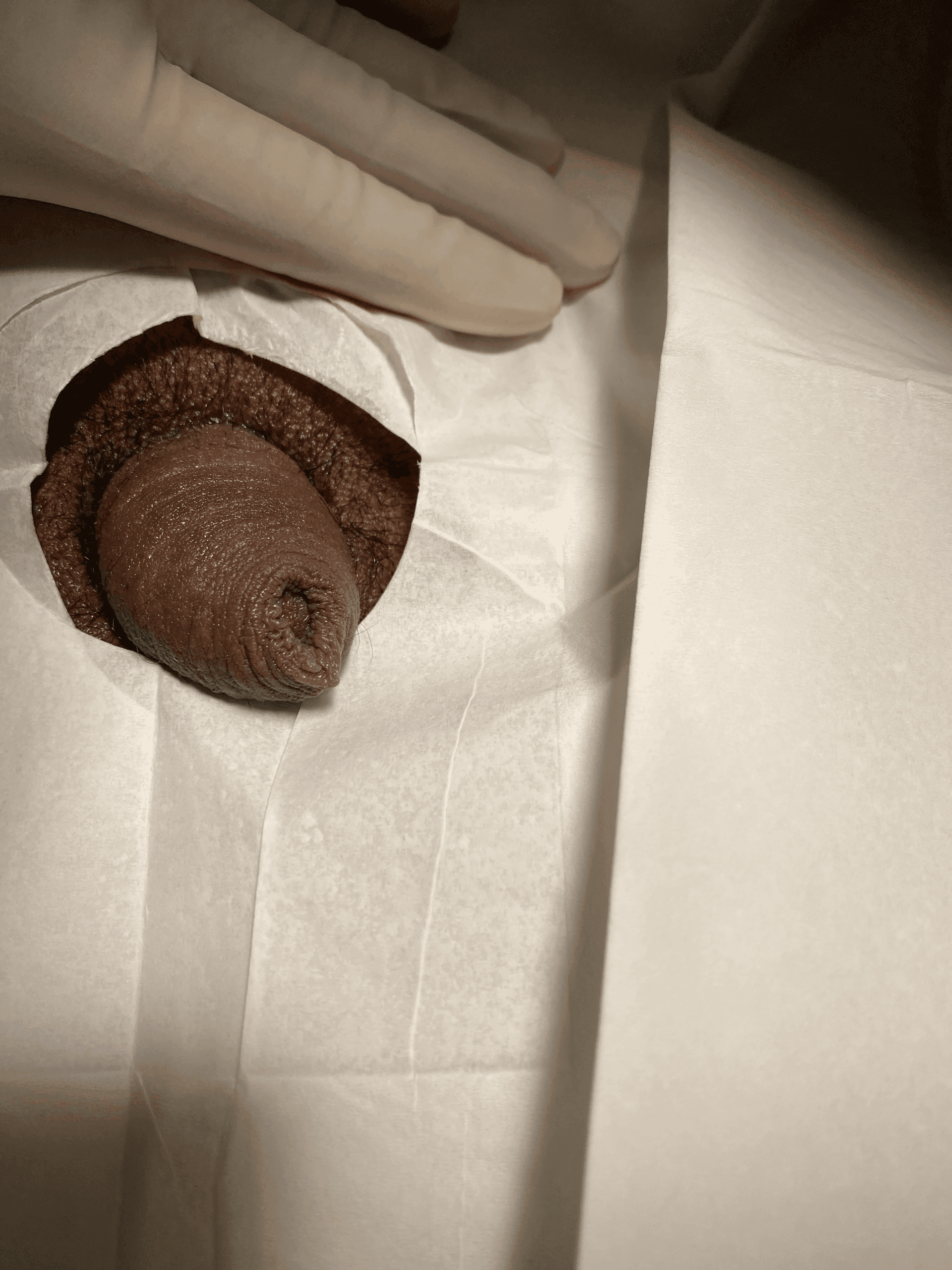 Patient O — clinical photograph 1 of 4