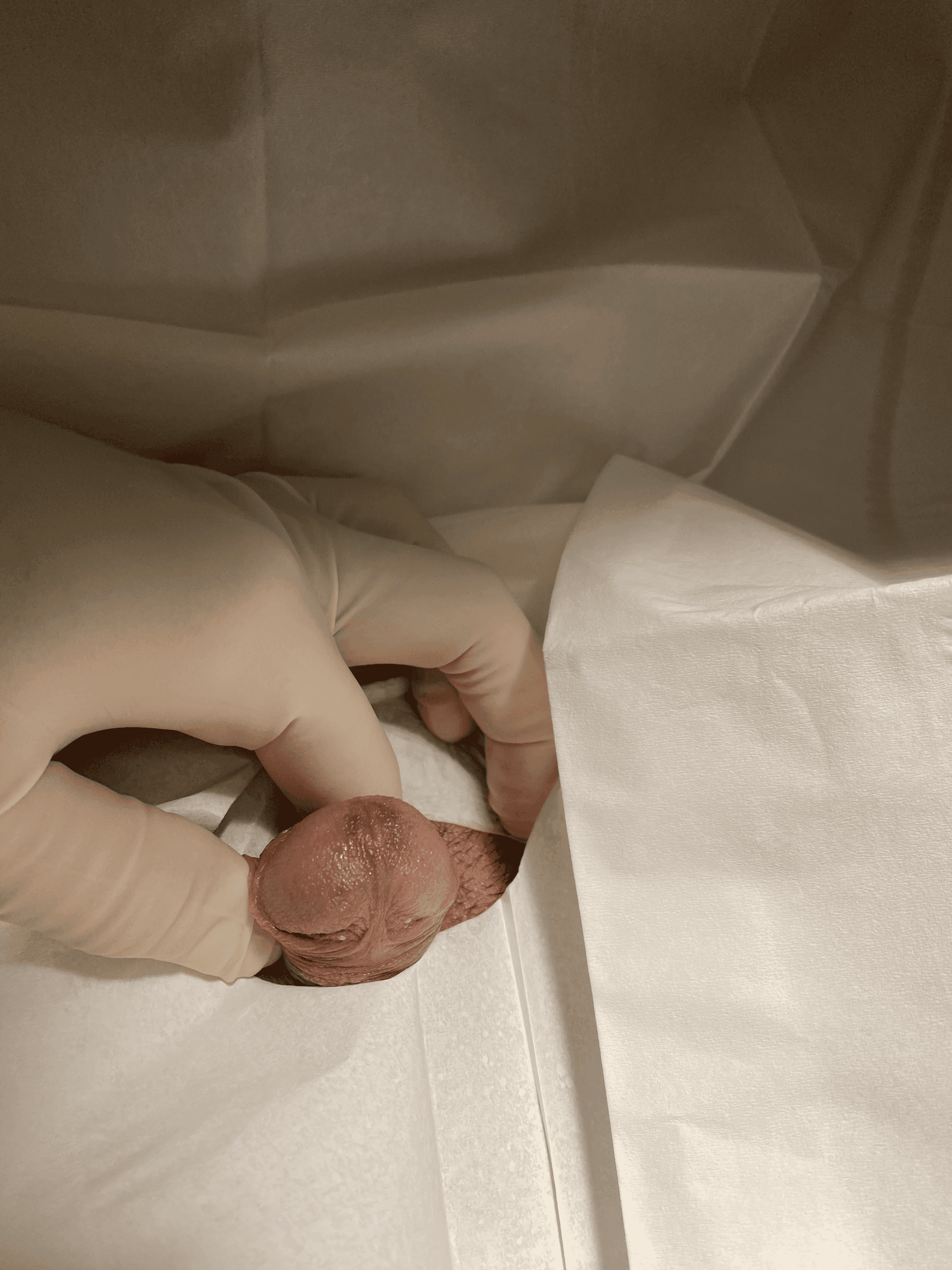 Patient O — clinical photograph 2 of 4