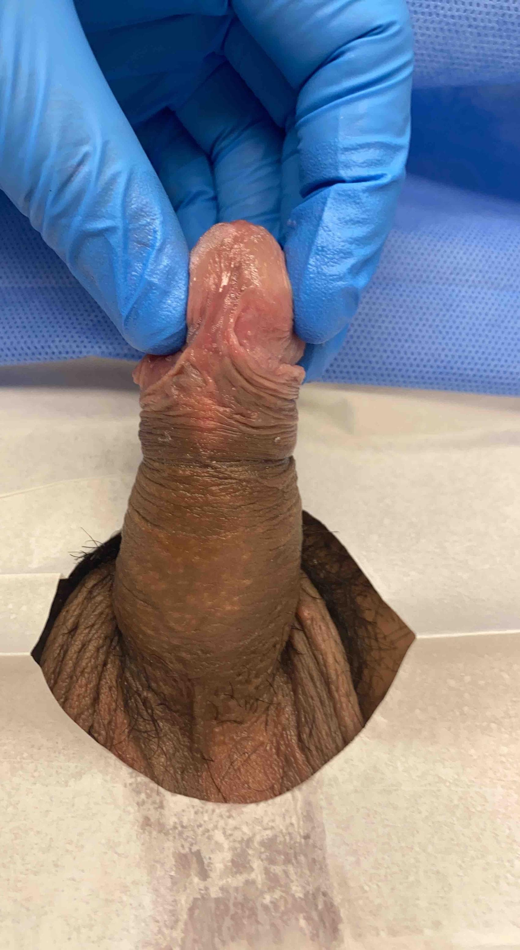 Patient P — clinical photograph 1 of 4