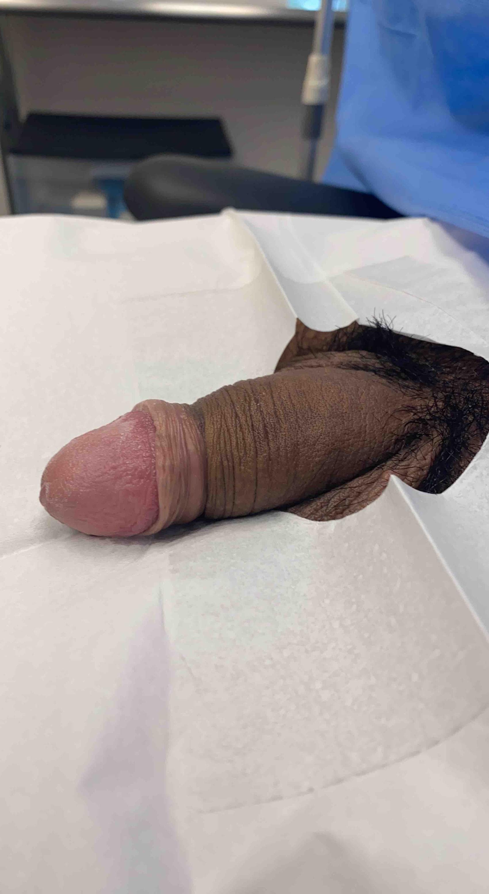 Patient P — clinical photograph 2 of 4