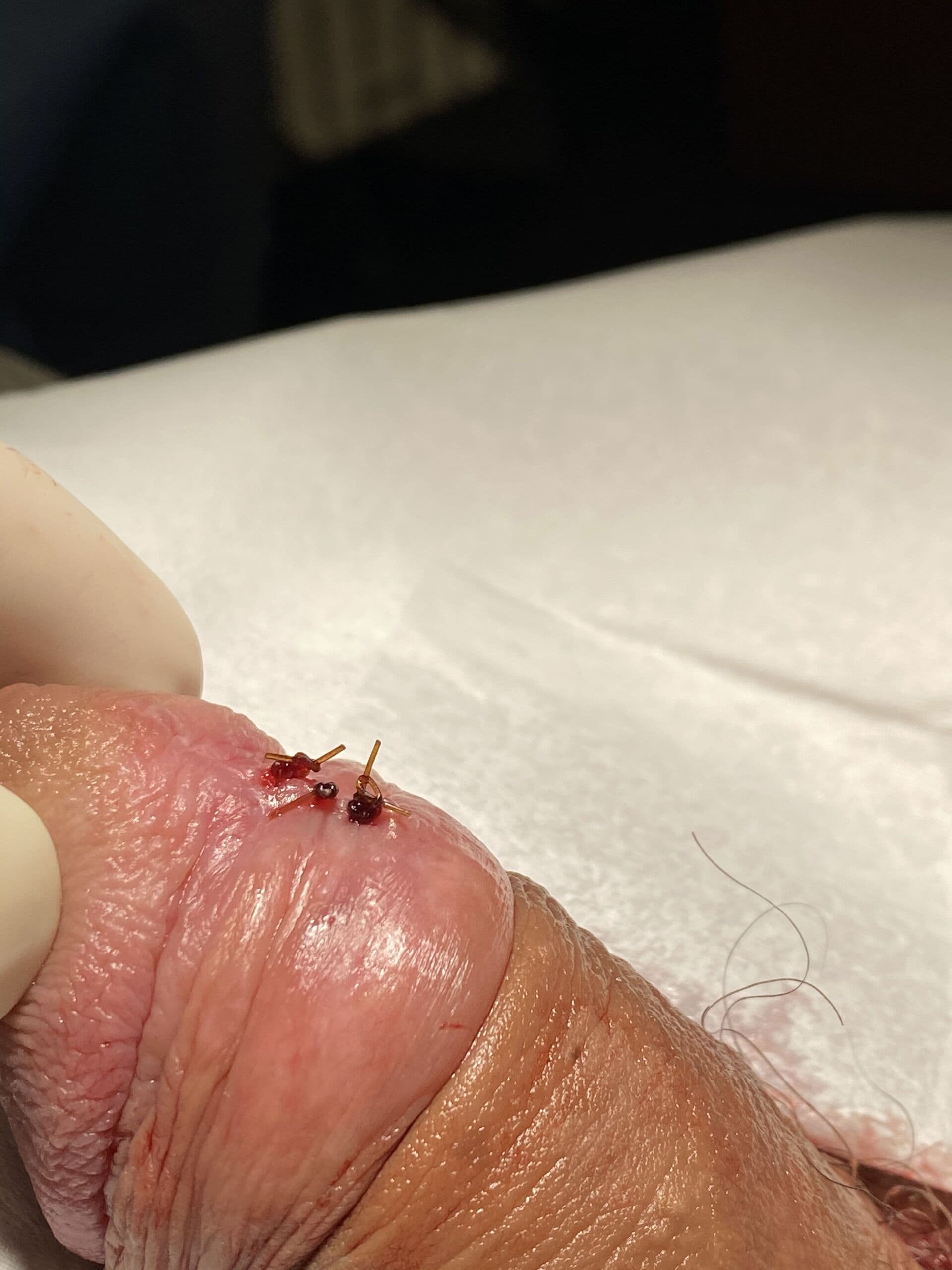 Patient Q — clinical photograph 3 of 4