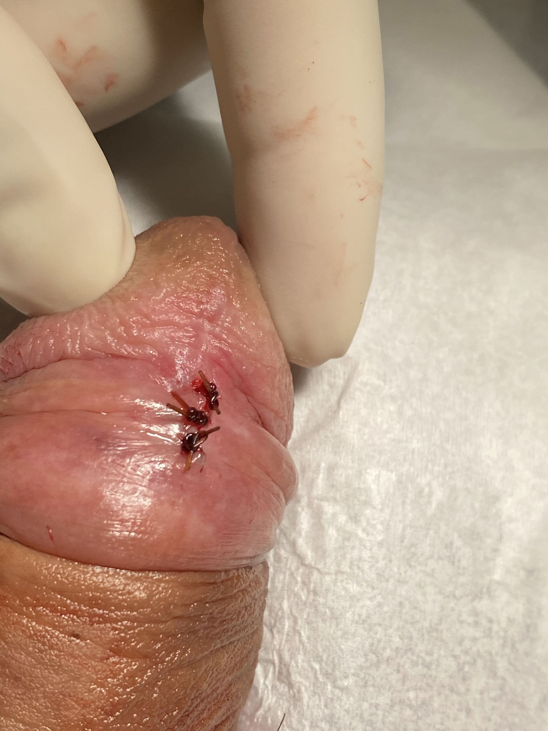 Patient Q — clinical photograph 4 of 4