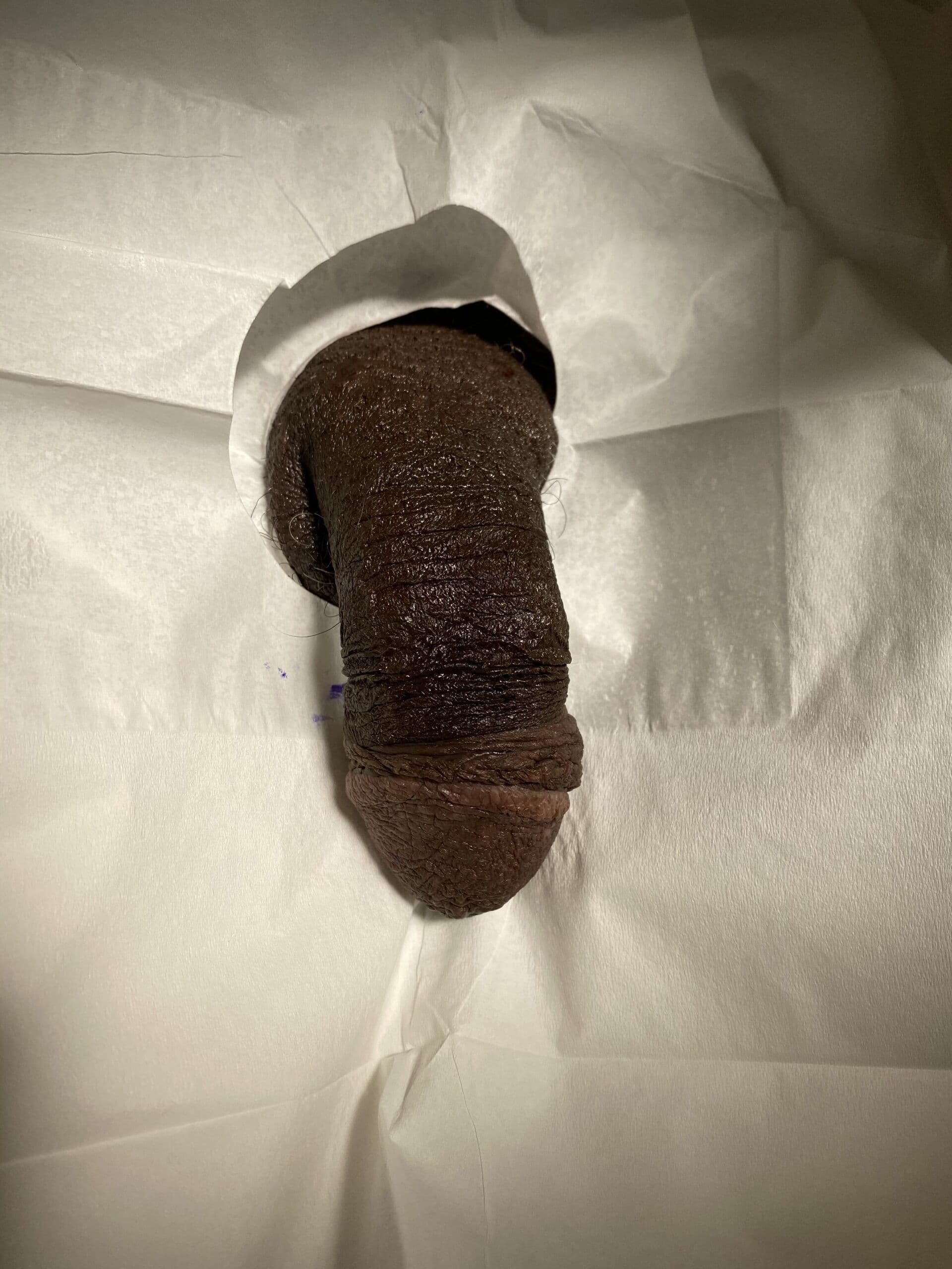 Patient R — clinical photograph 1 of 6