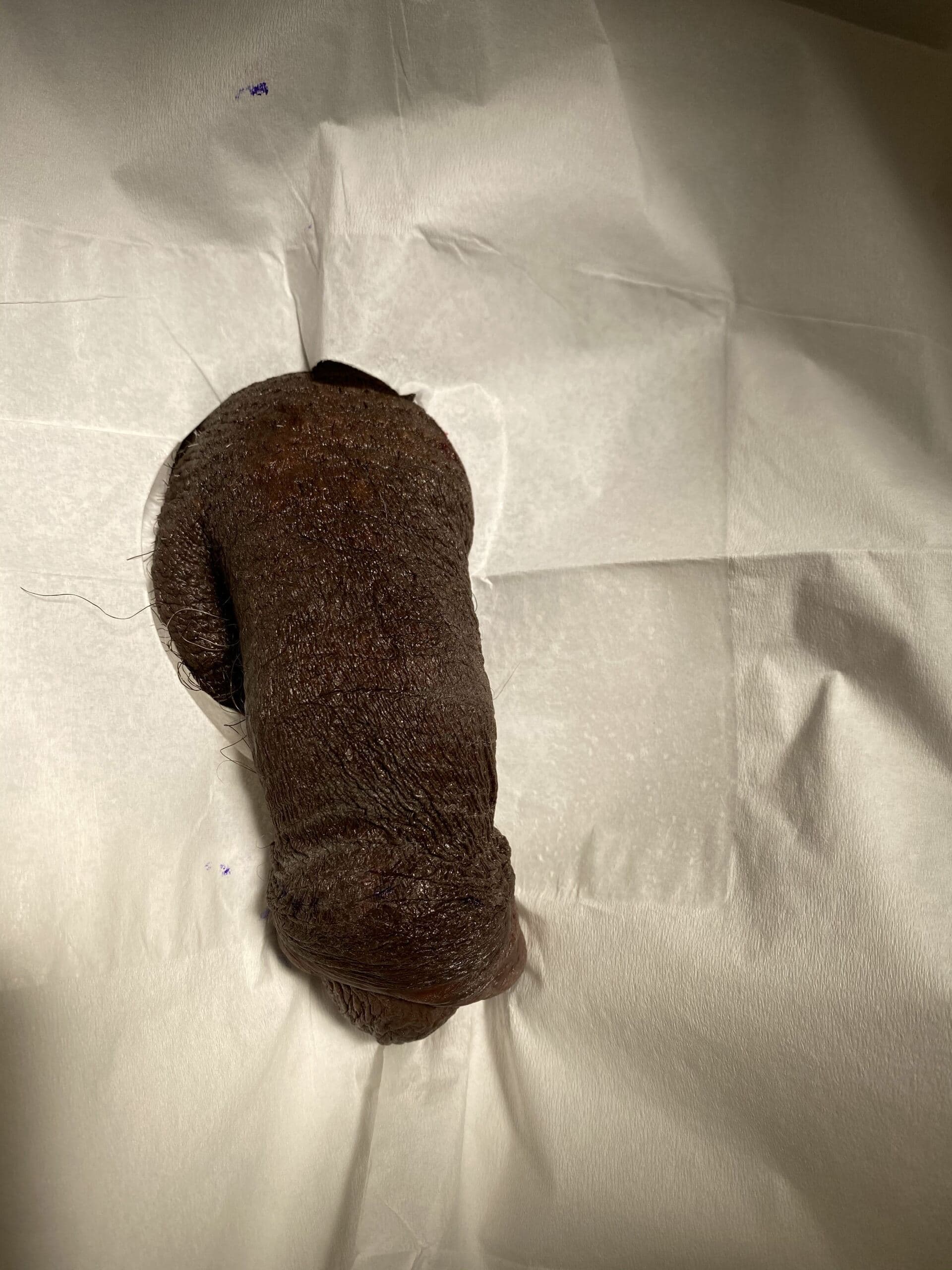 Patient R — clinical photograph 2 of 6