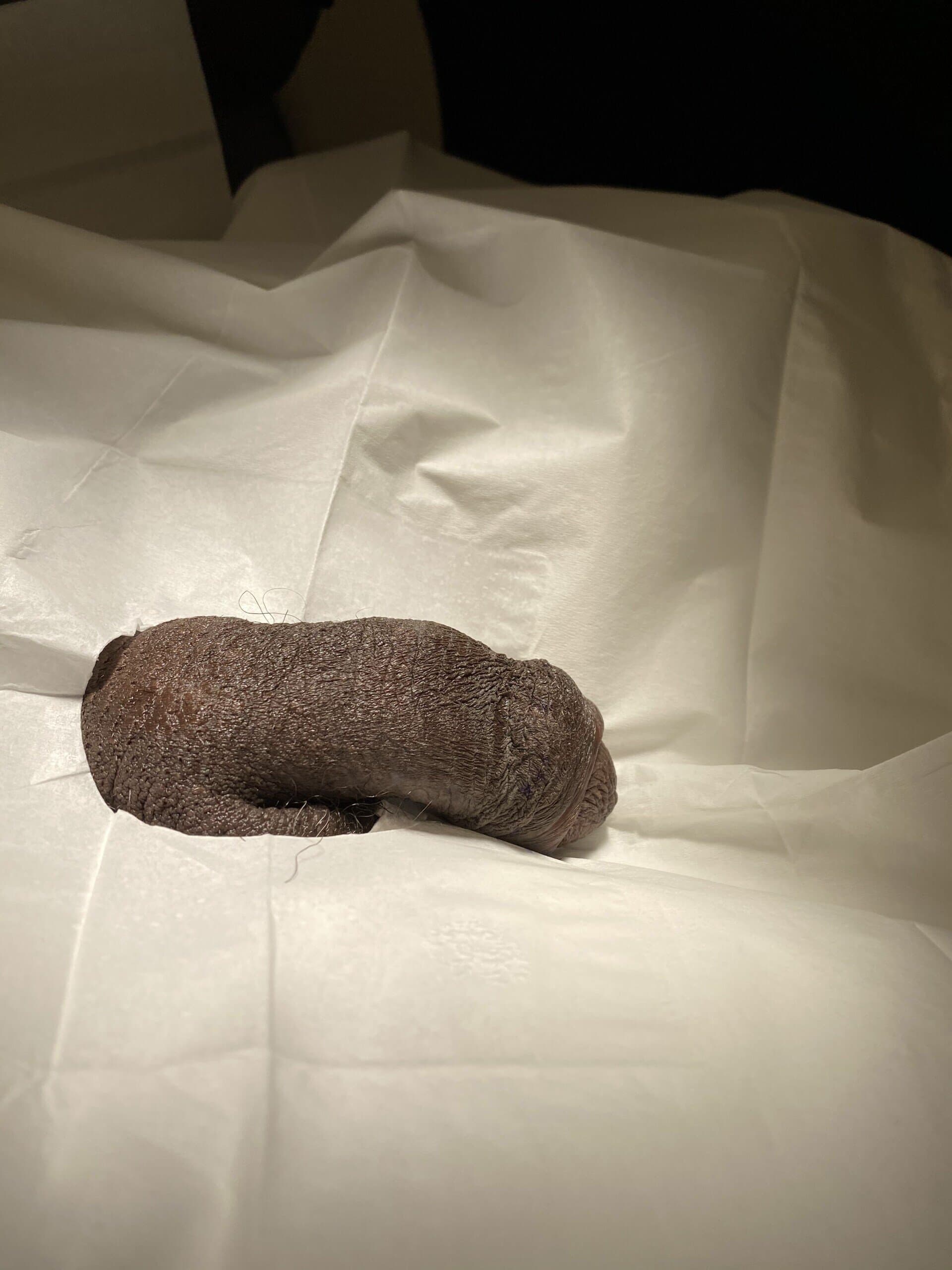 Patient R — clinical photograph 3 of 6