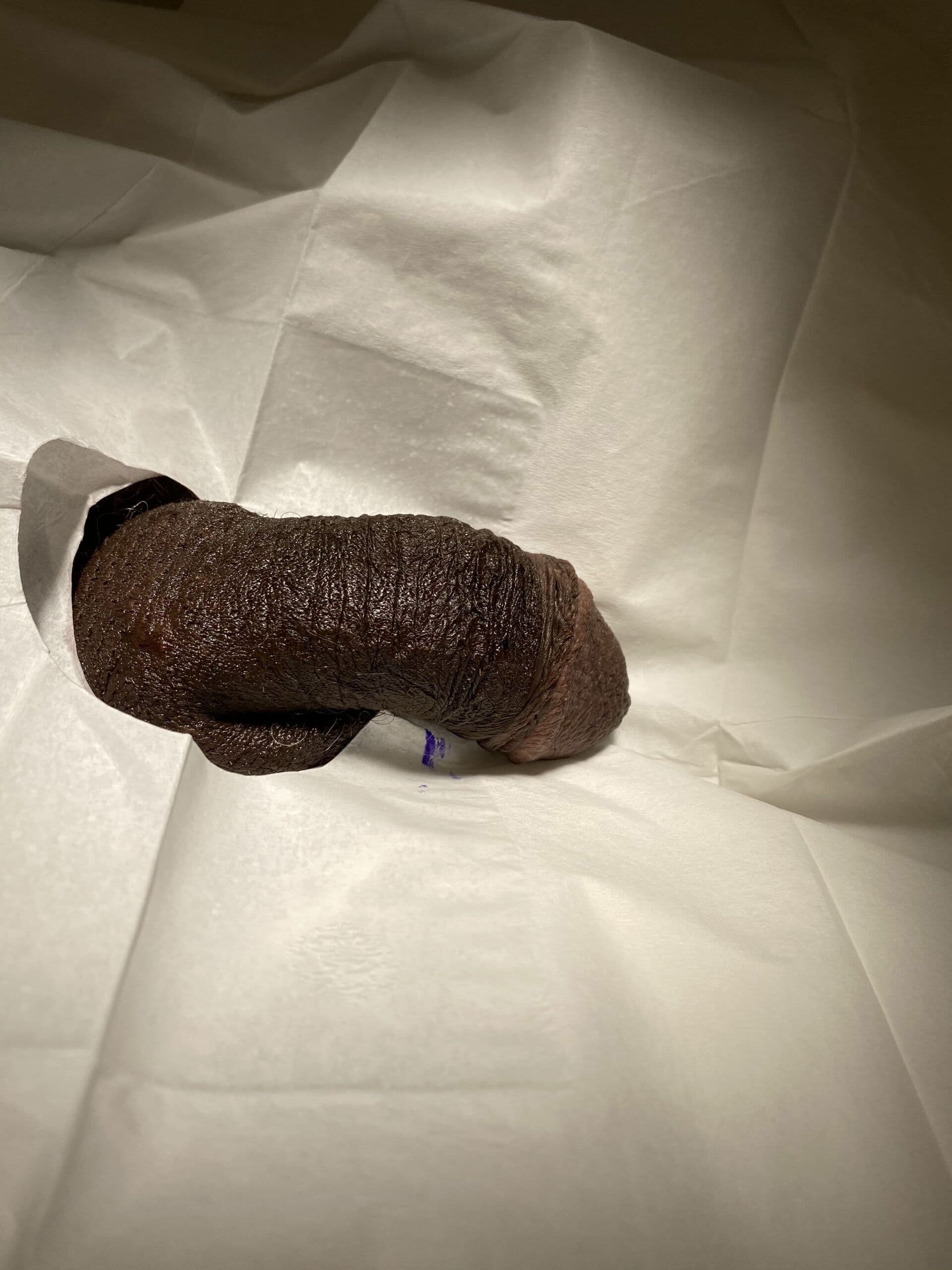 Patient R — clinical photograph 4 of 6