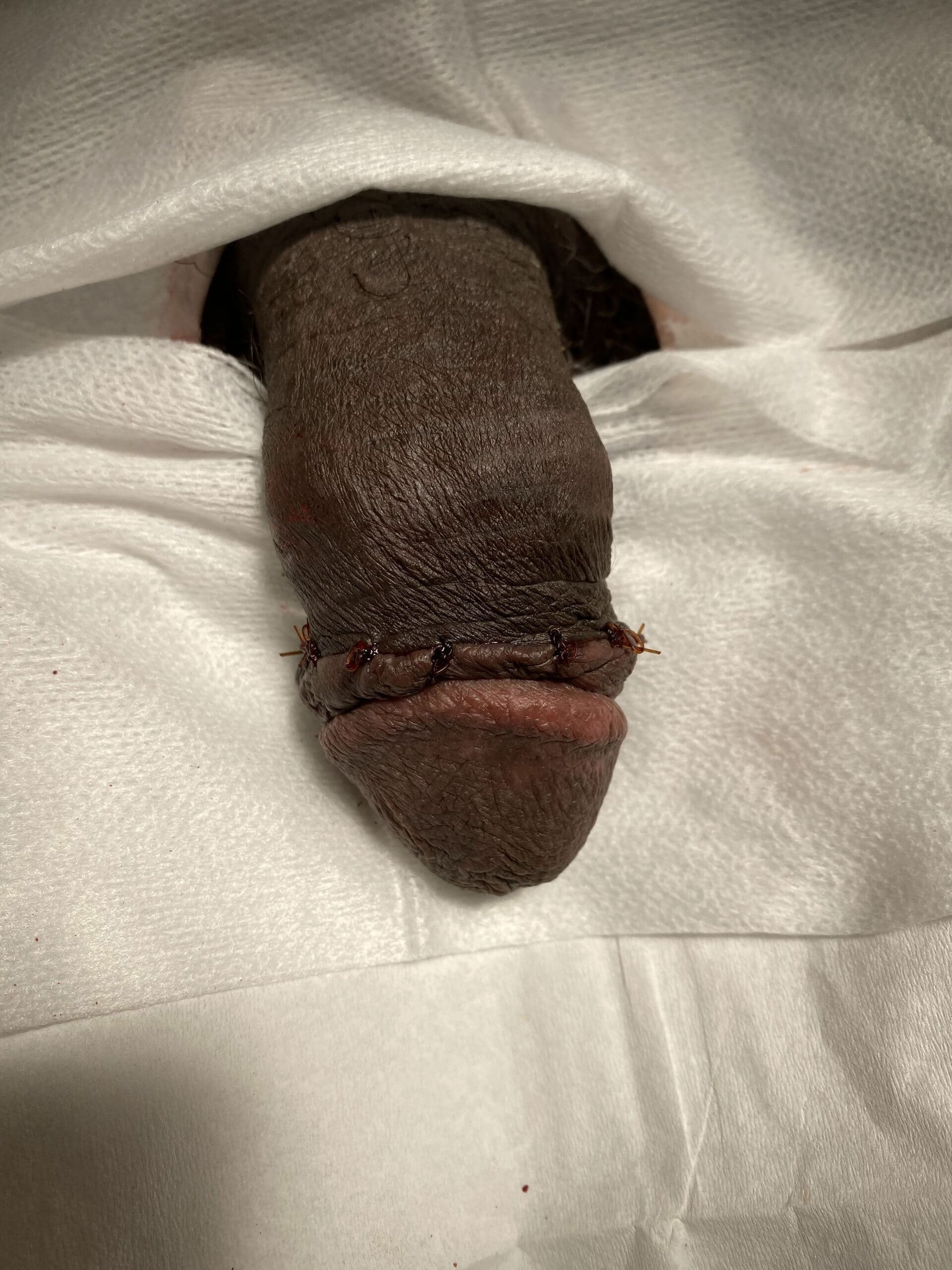 Patient R — clinical photograph 5 of 6