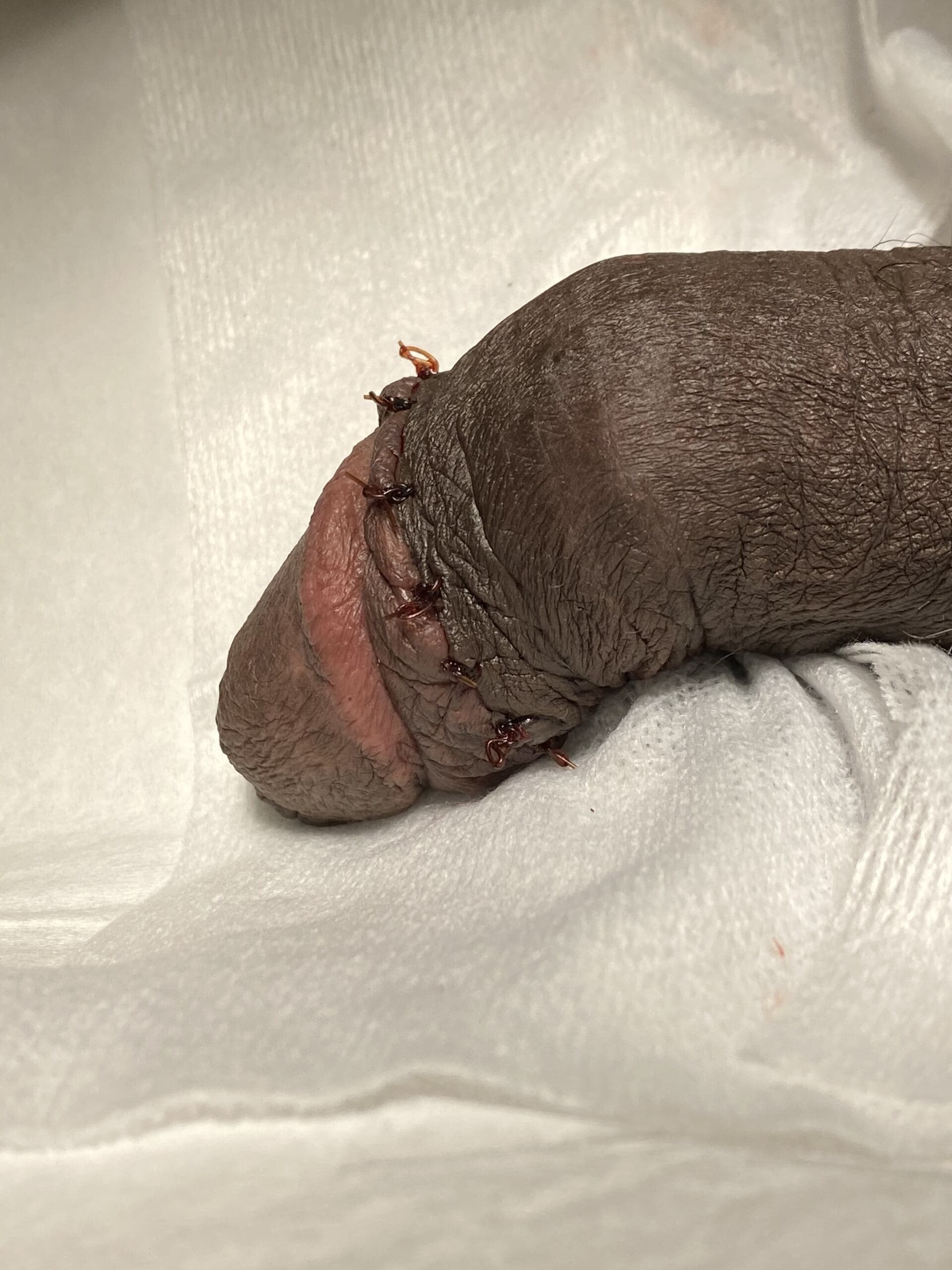 Patient R — clinical photograph 6 of 6