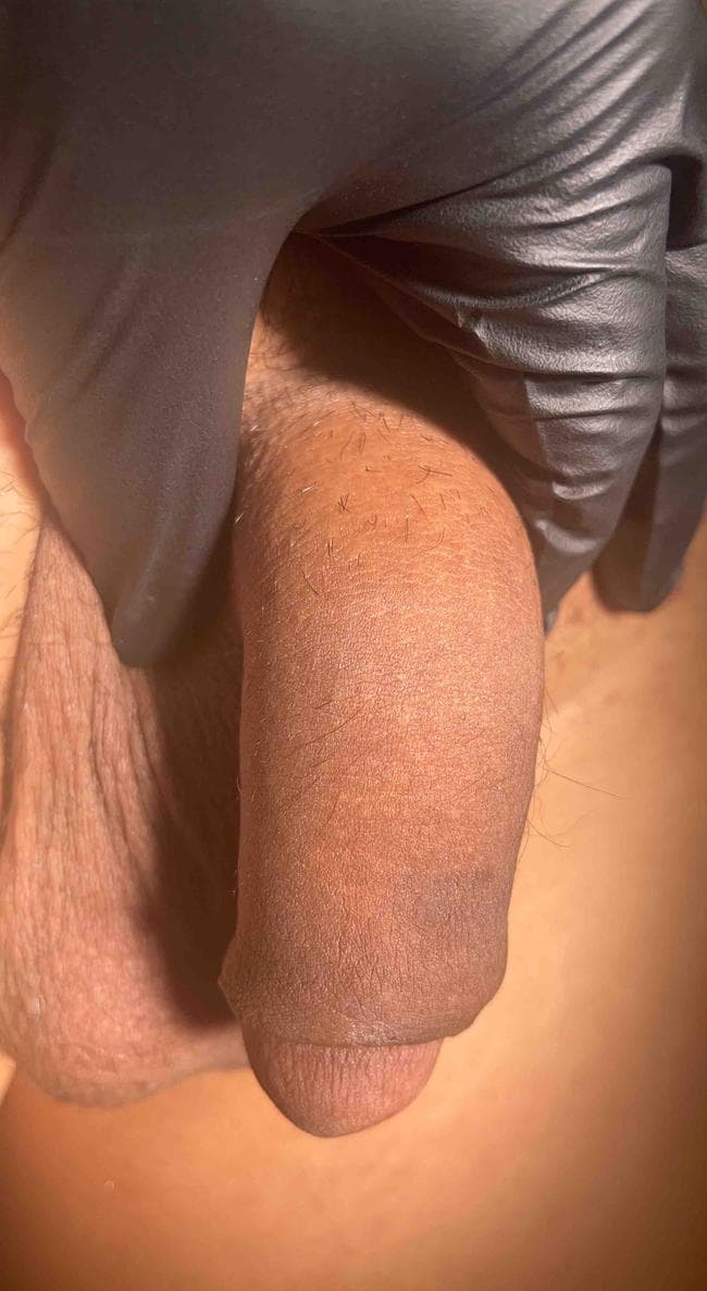 Patient S — clinical photograph 1 of 8