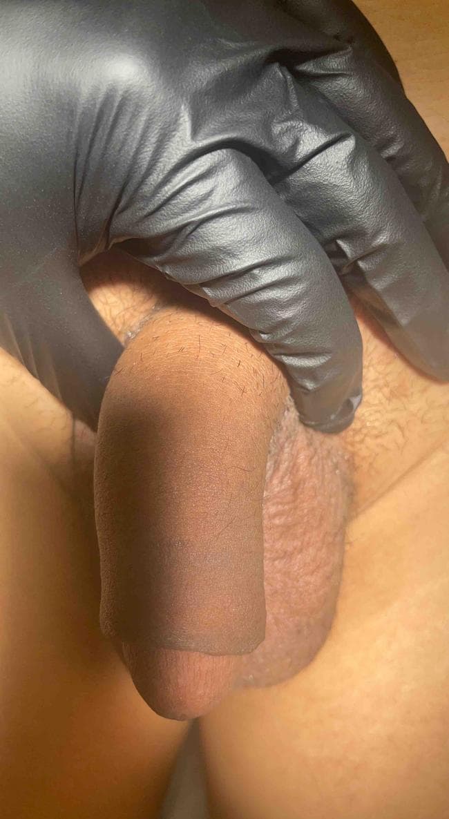 Patient S — clinical photograph 2 of 8