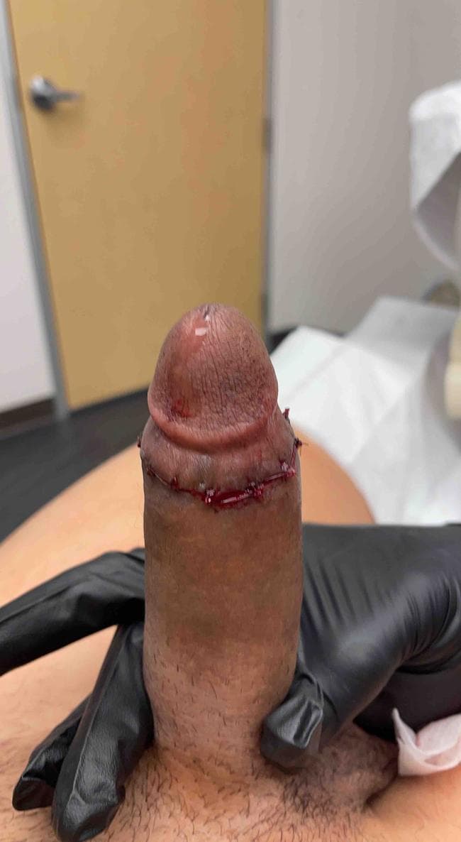 Patient S — clinical photograph 6 of 8