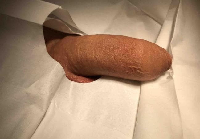 Patient T — clinical photograph 1 of 6