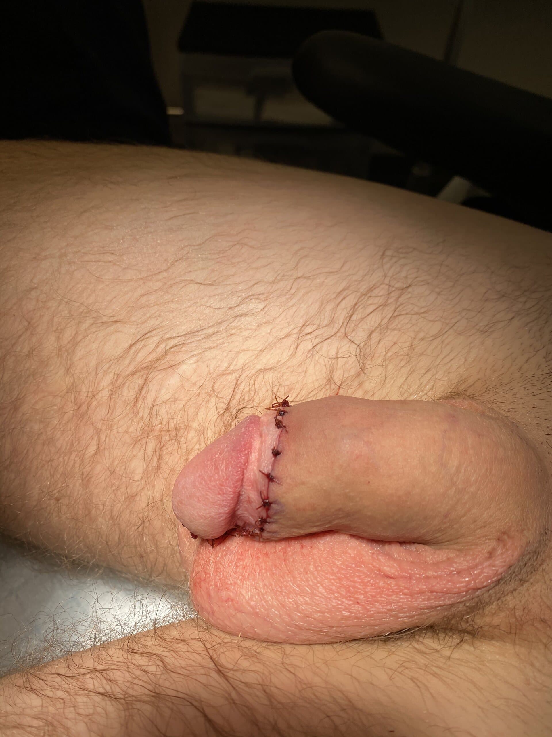 Patient T — clinical photograph 2 of 6