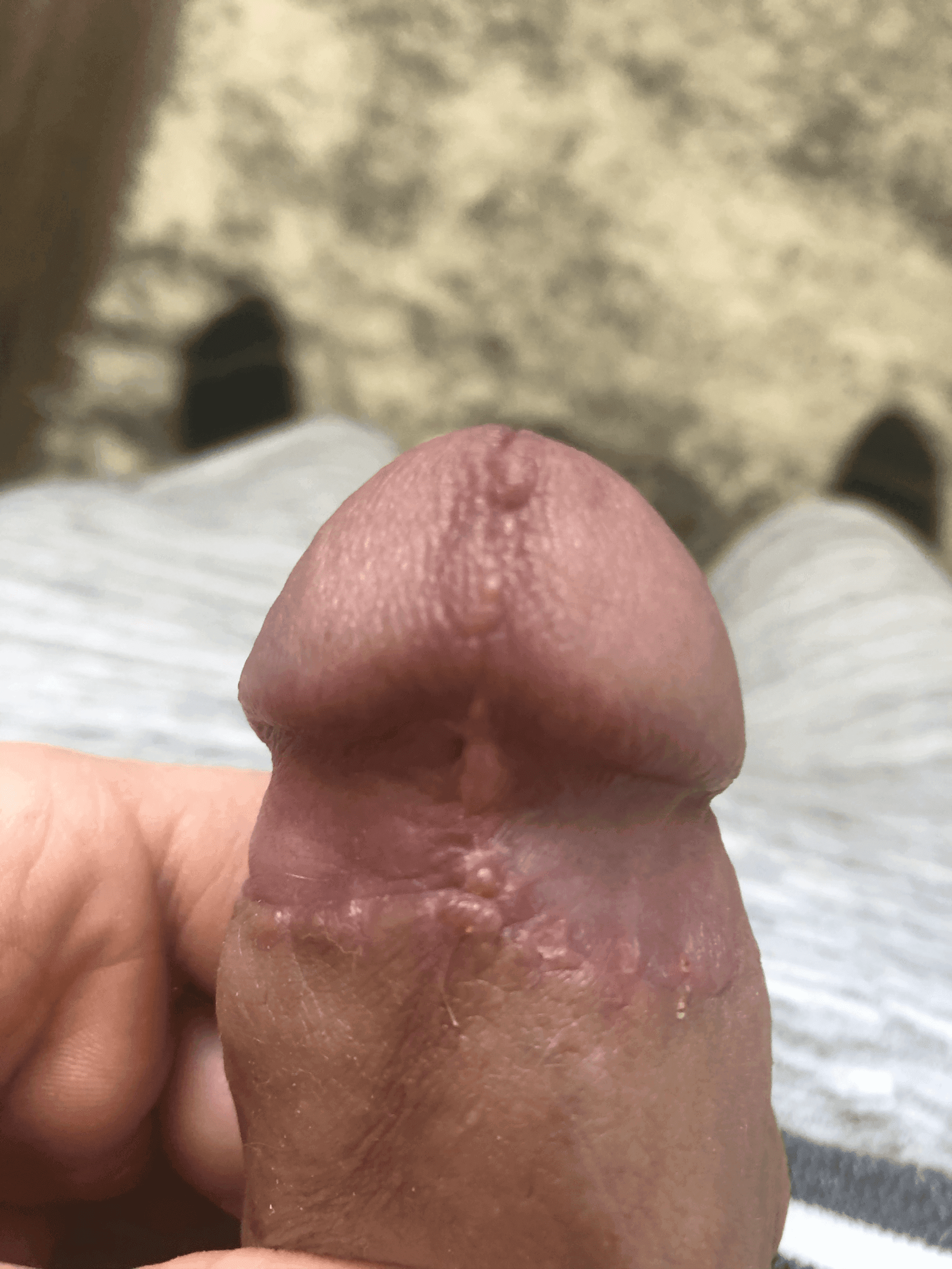 Patient T — clinical photograph 4 of 6